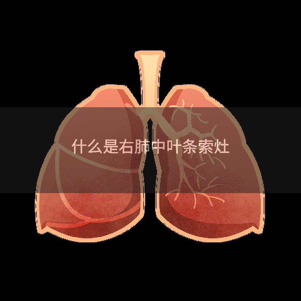 什么是右肺中叶条索灶