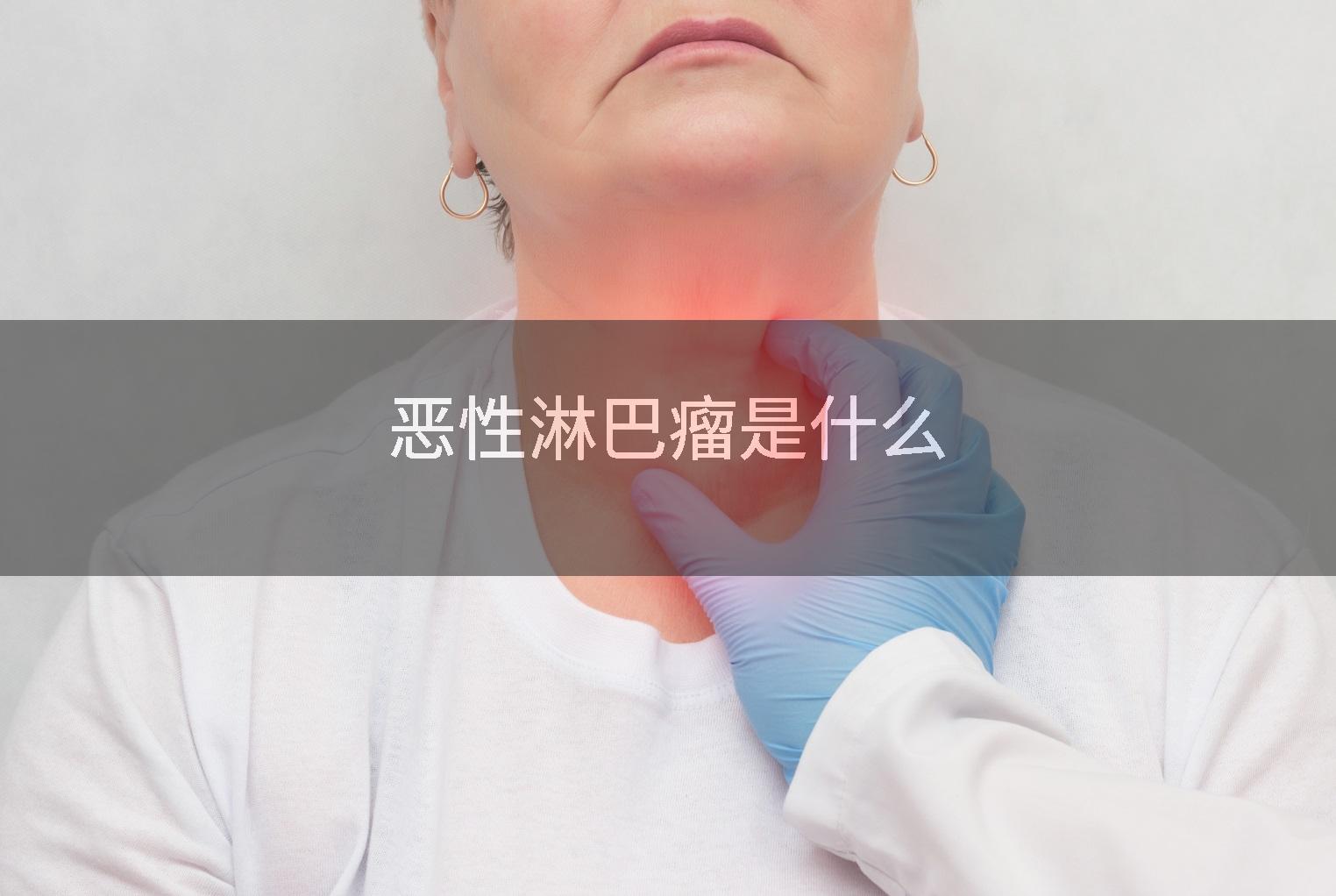 恶性淋巴瘤是什么