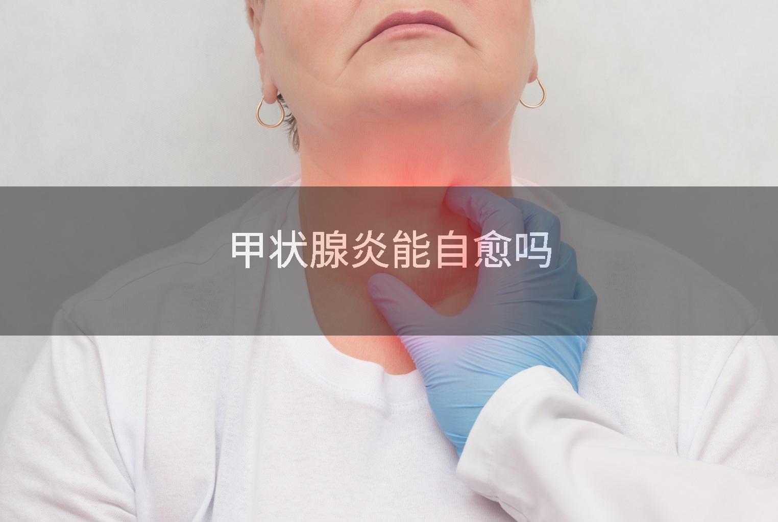 甲状腺炎能自愈吗