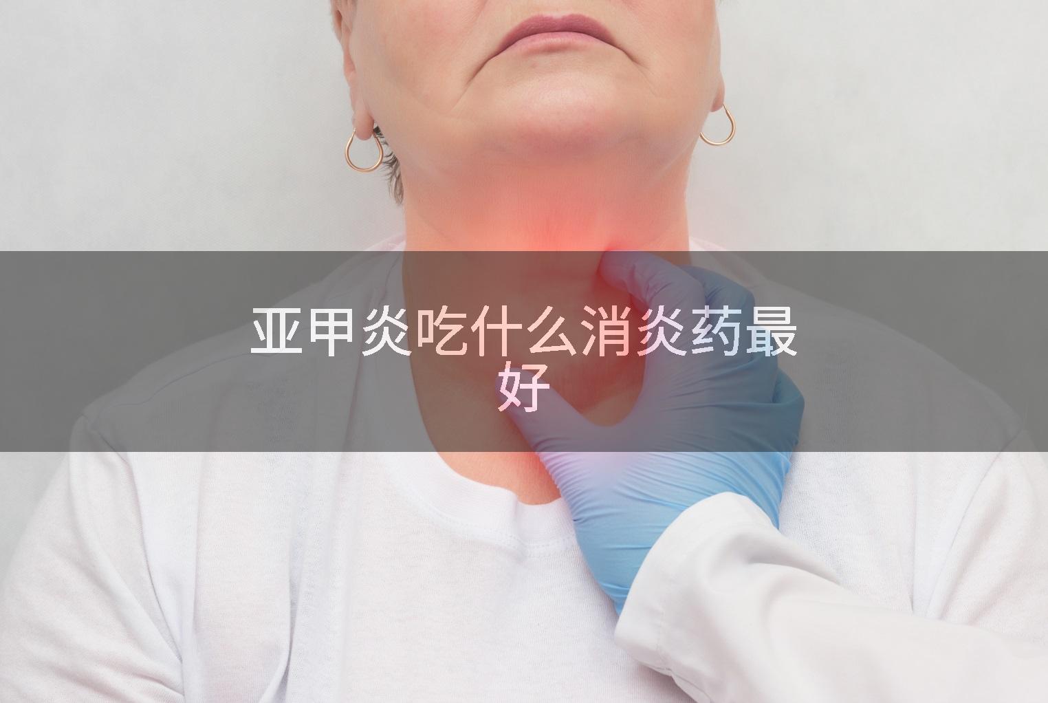 亚甲炎吃什么消炎药最好
