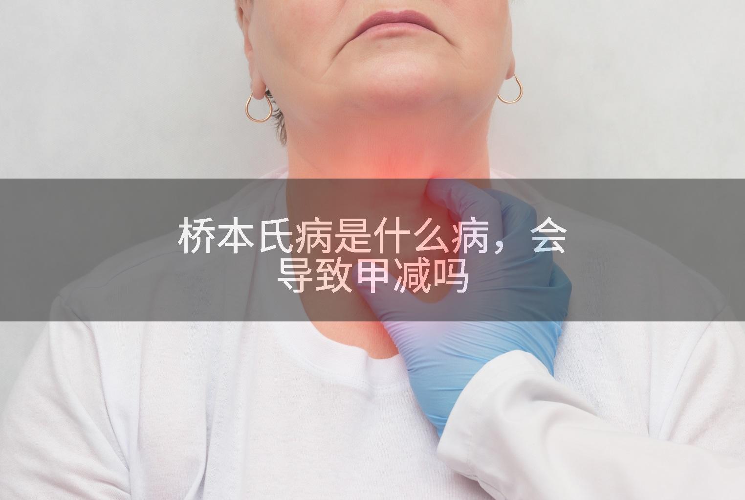 桥本氏病是什么病，会导致甲减吗