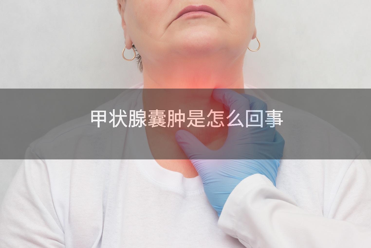甲状腺囊肿是怎么回事