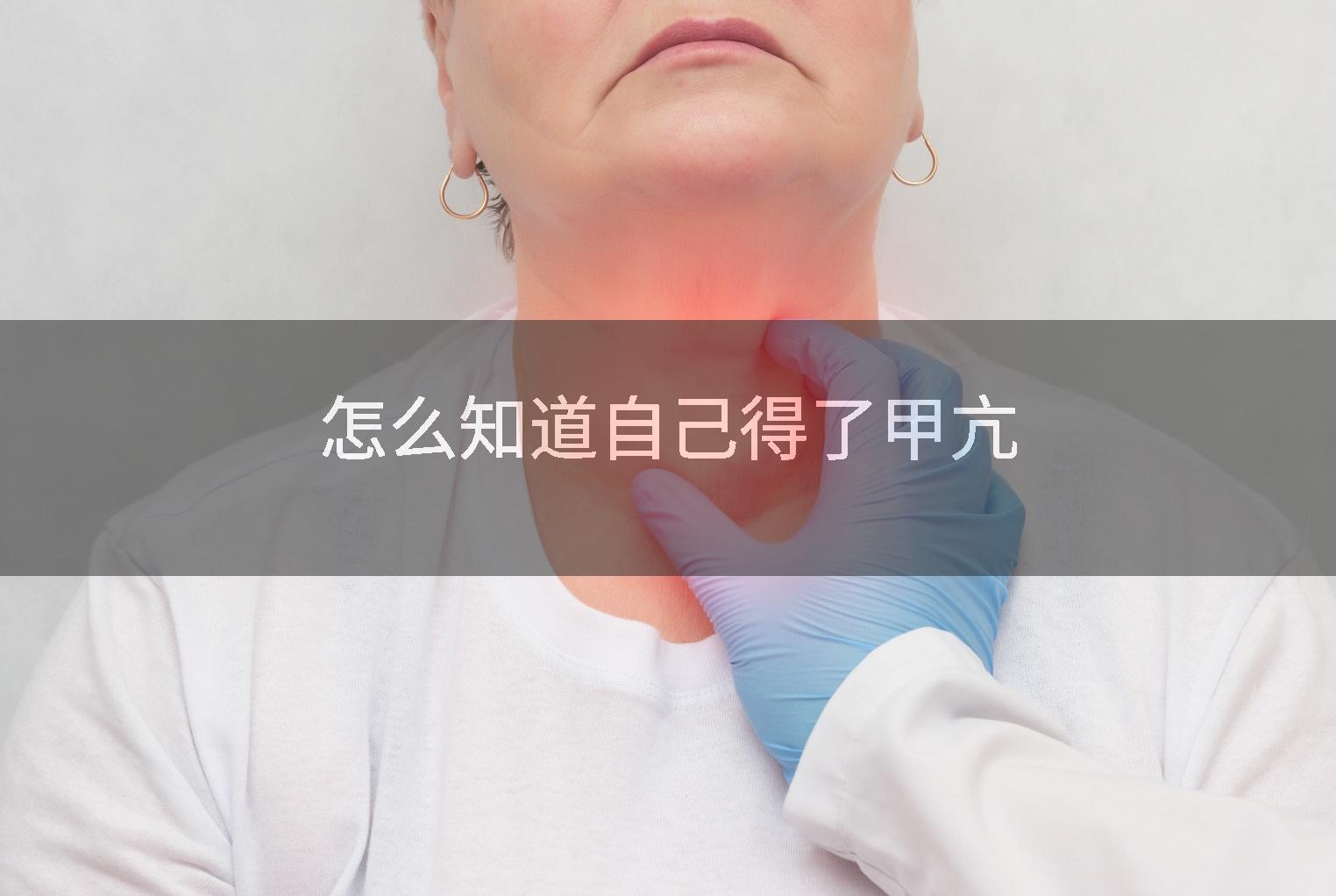 怎么知道自己得了甲亢