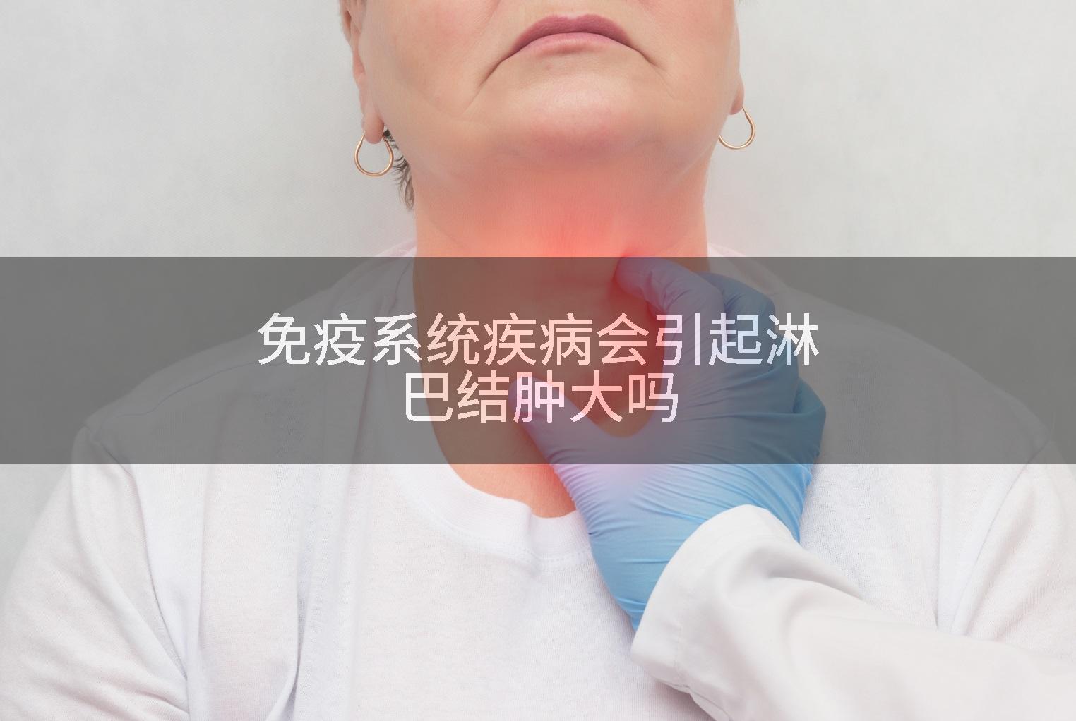 免疫系统疾病会引起淋巴结肿大吗