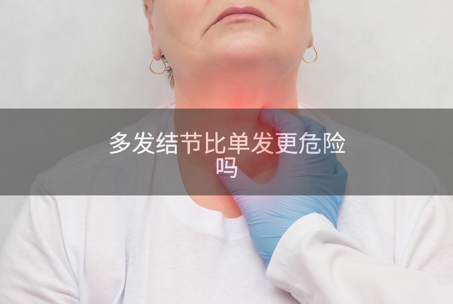 多发结节比单发更危险吗