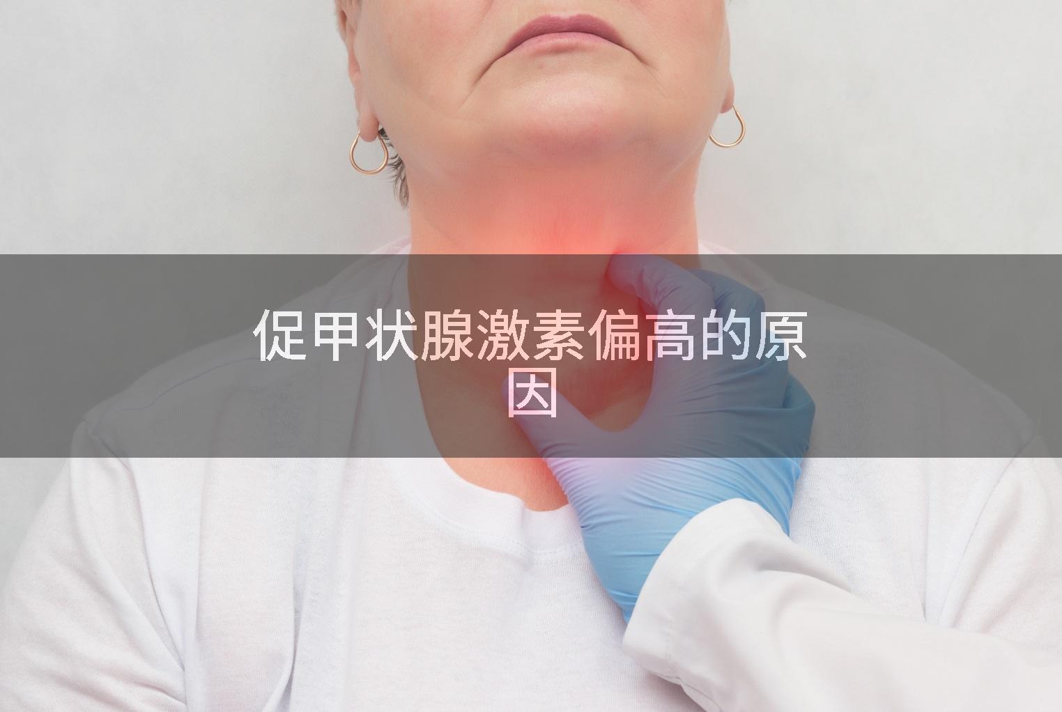 促甲状腺激素偏高的原因