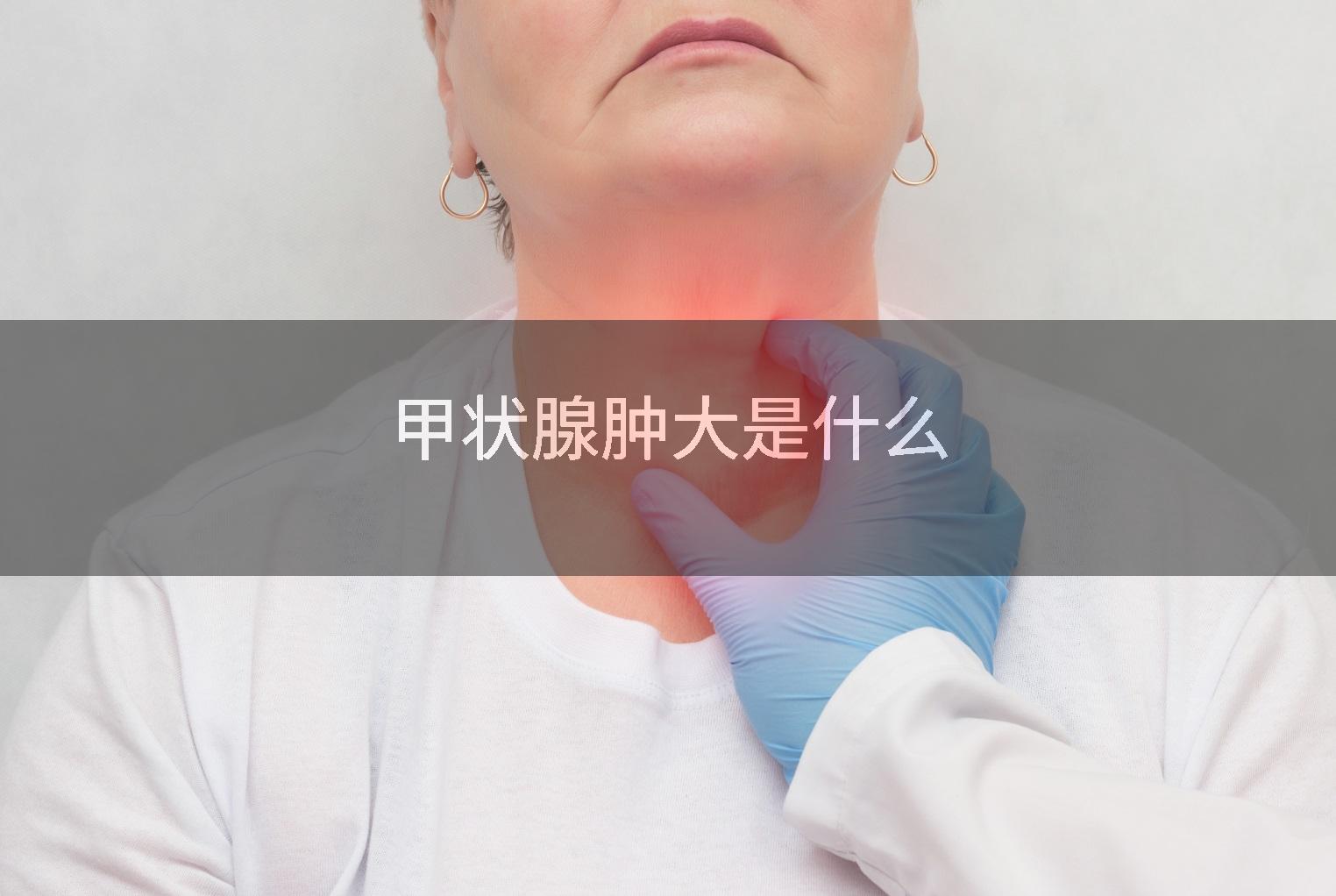 甲状腺肿大是什么
