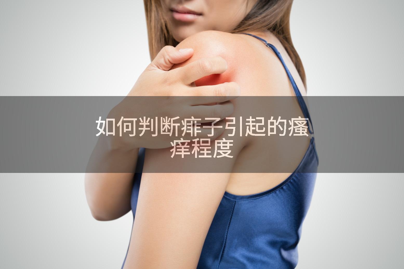 如何判断痱子引起的瘙痒程度