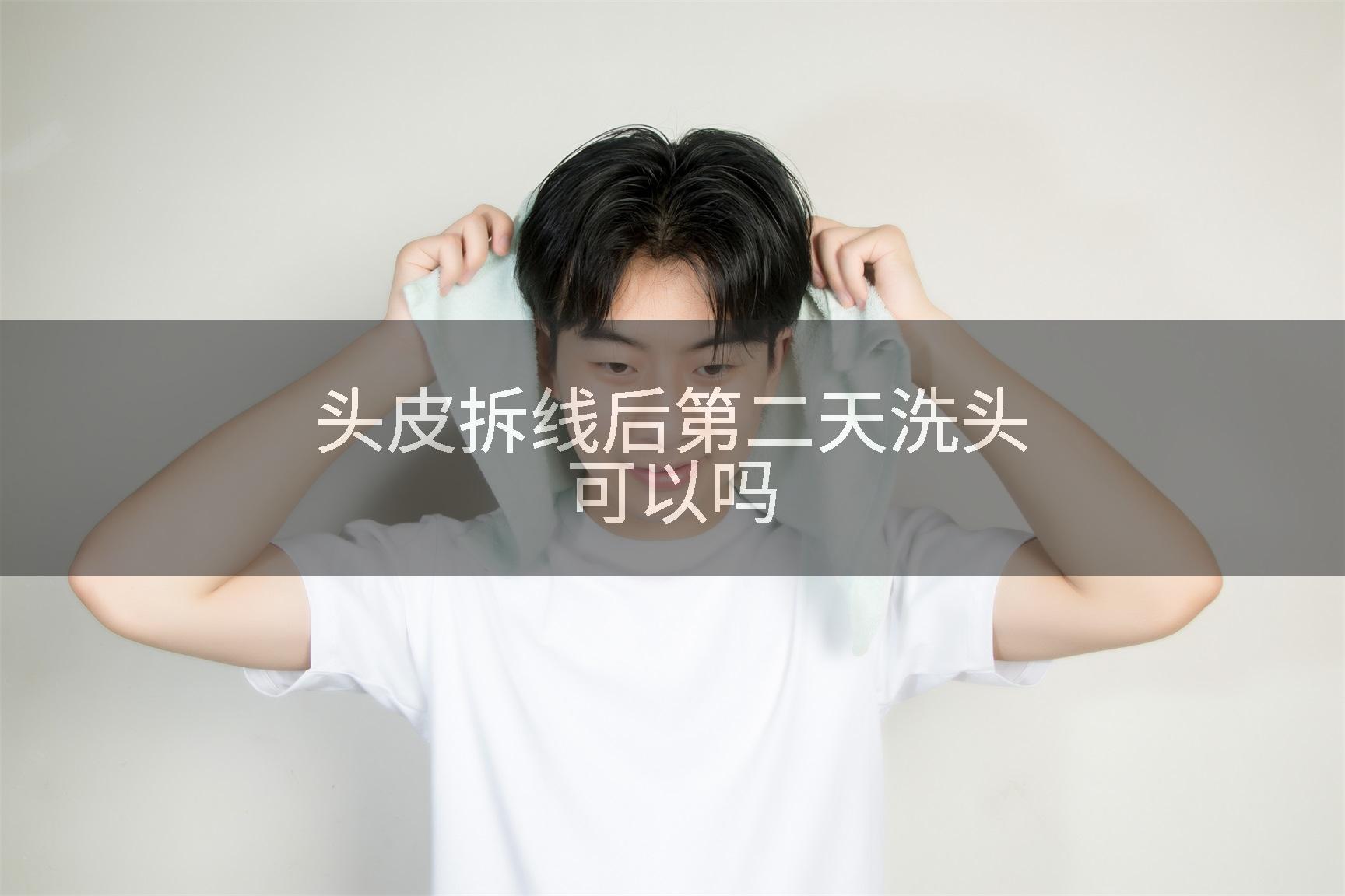 头皮拆线后第二天洗头可以吗