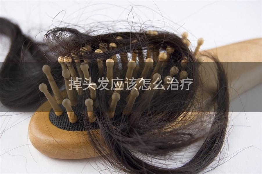 掉头发应该怎么治疗