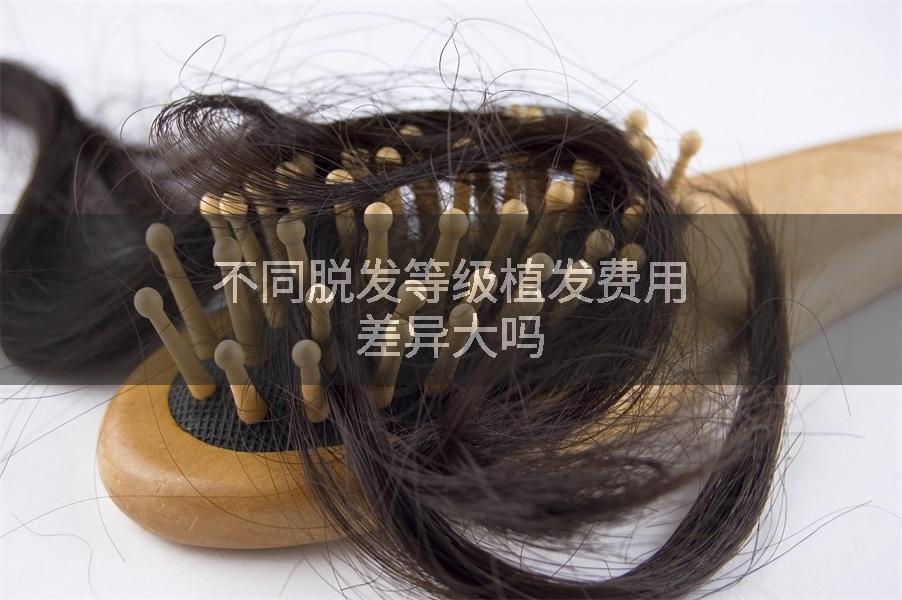 不同脱发等级植发费用差异大吗