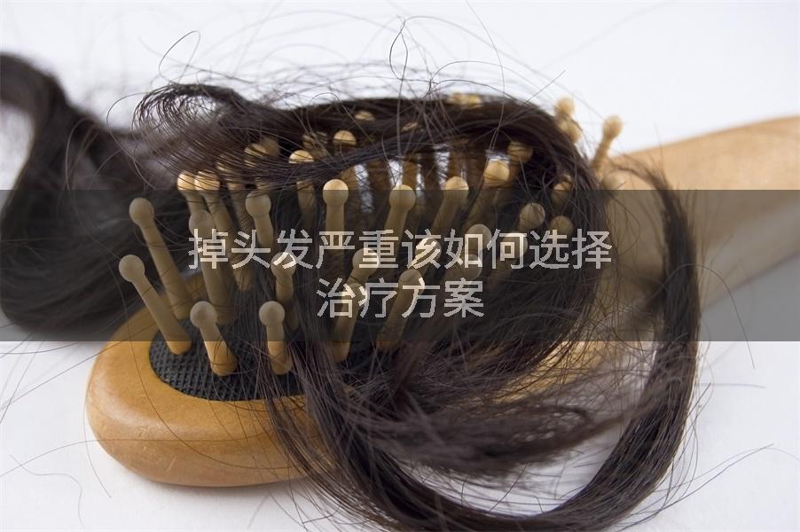 掉头发严重该如何选择治疗方案