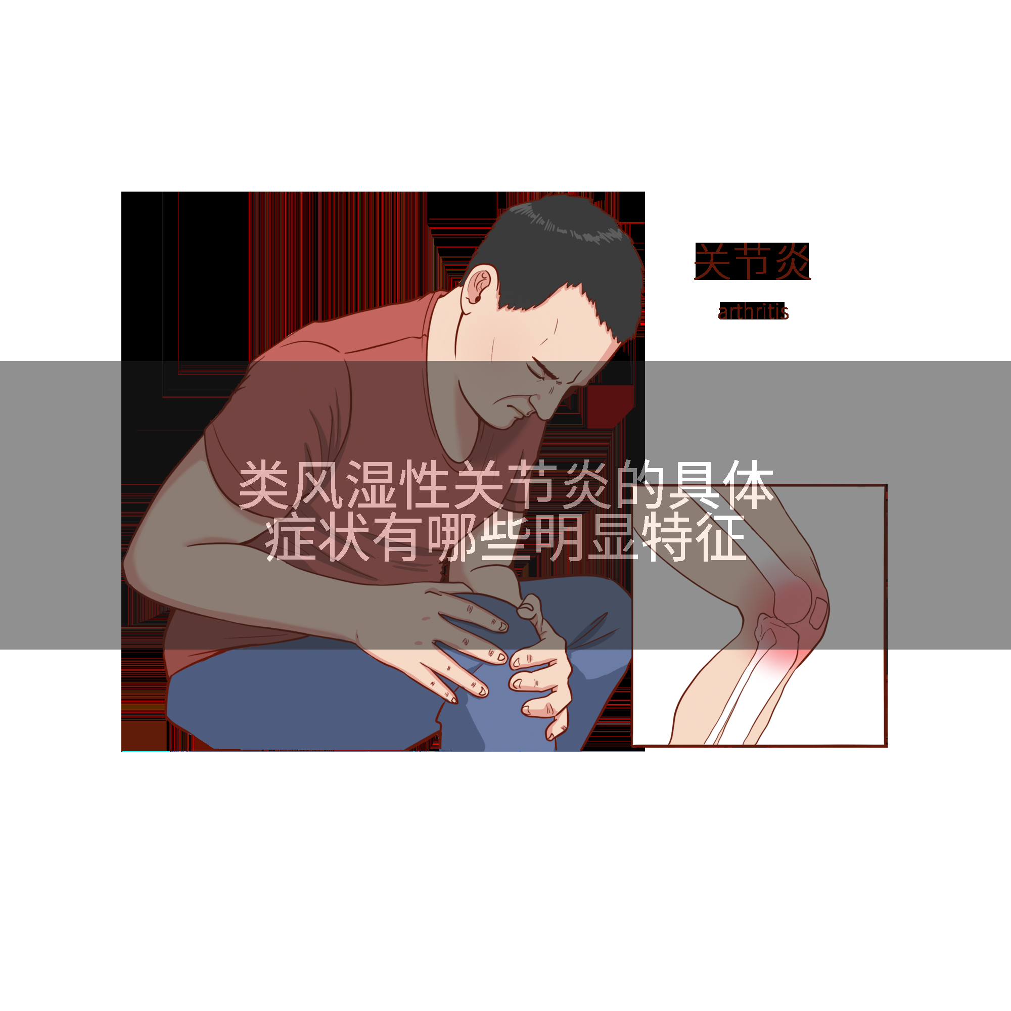 类风湿性关节炎的具体症状有哪些明显特征