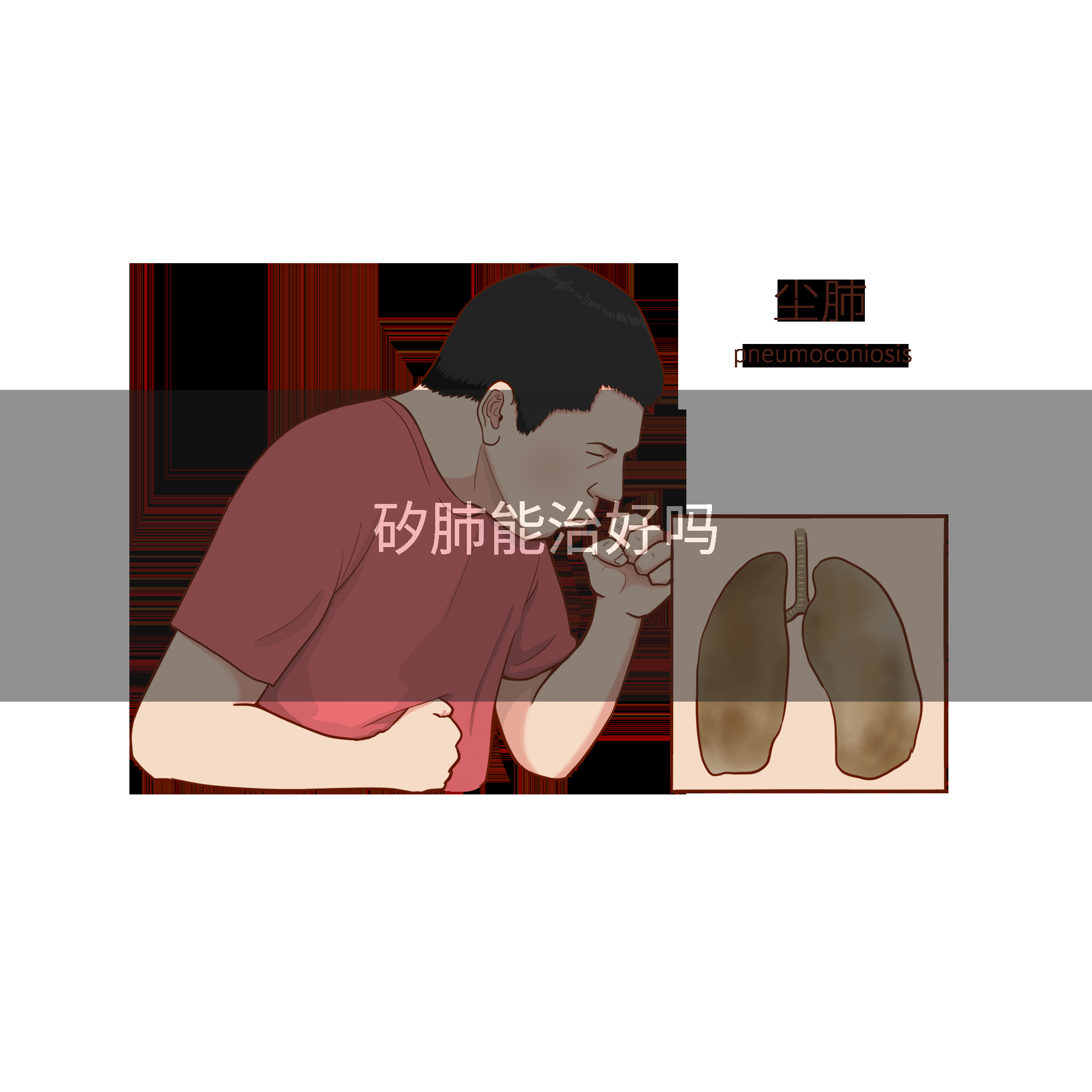 矽肺能治好吗