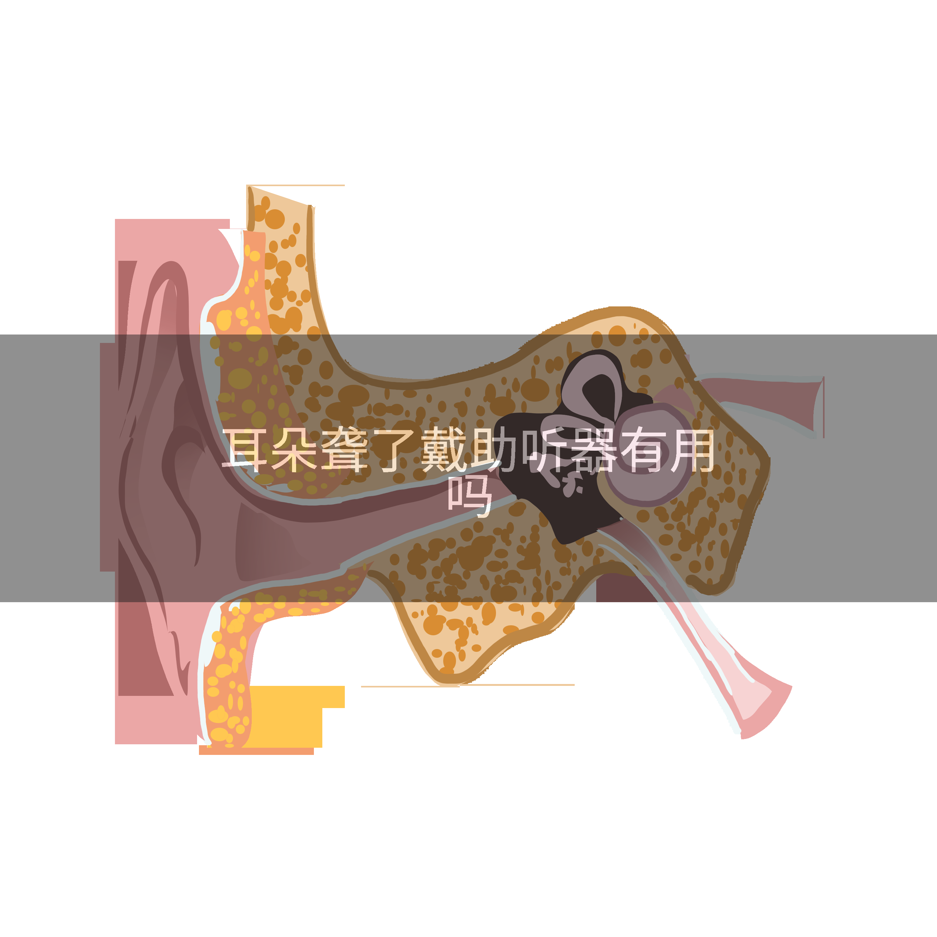 耳朵聋了戴助听器有用吗