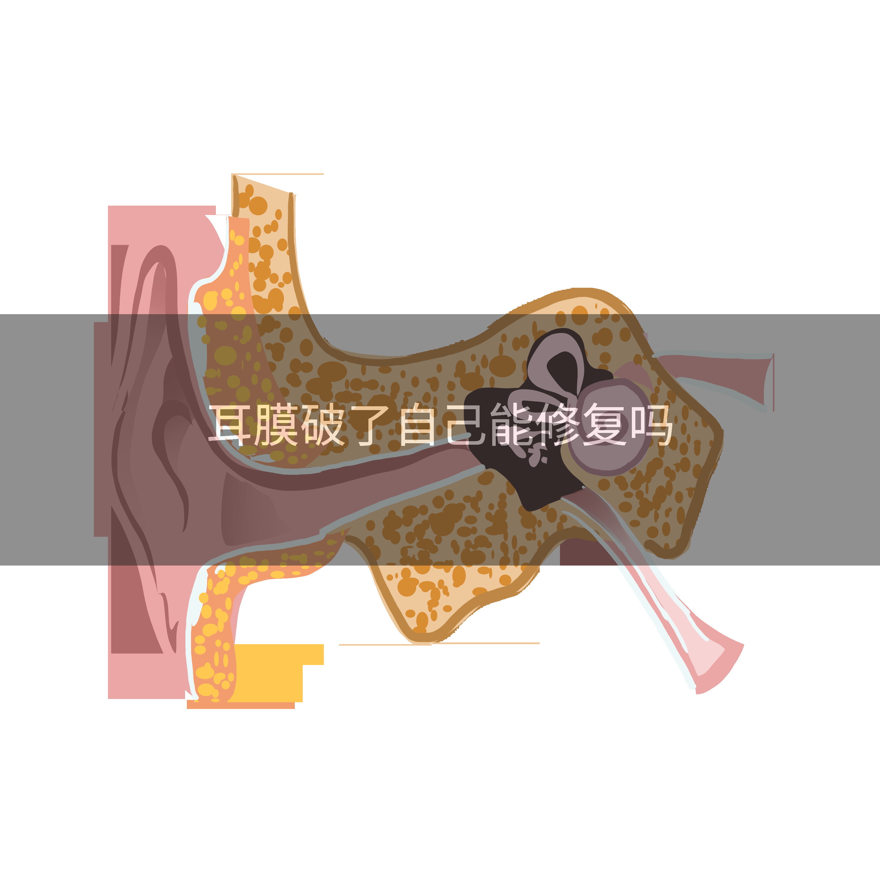 耳膜破了自己能修复吗