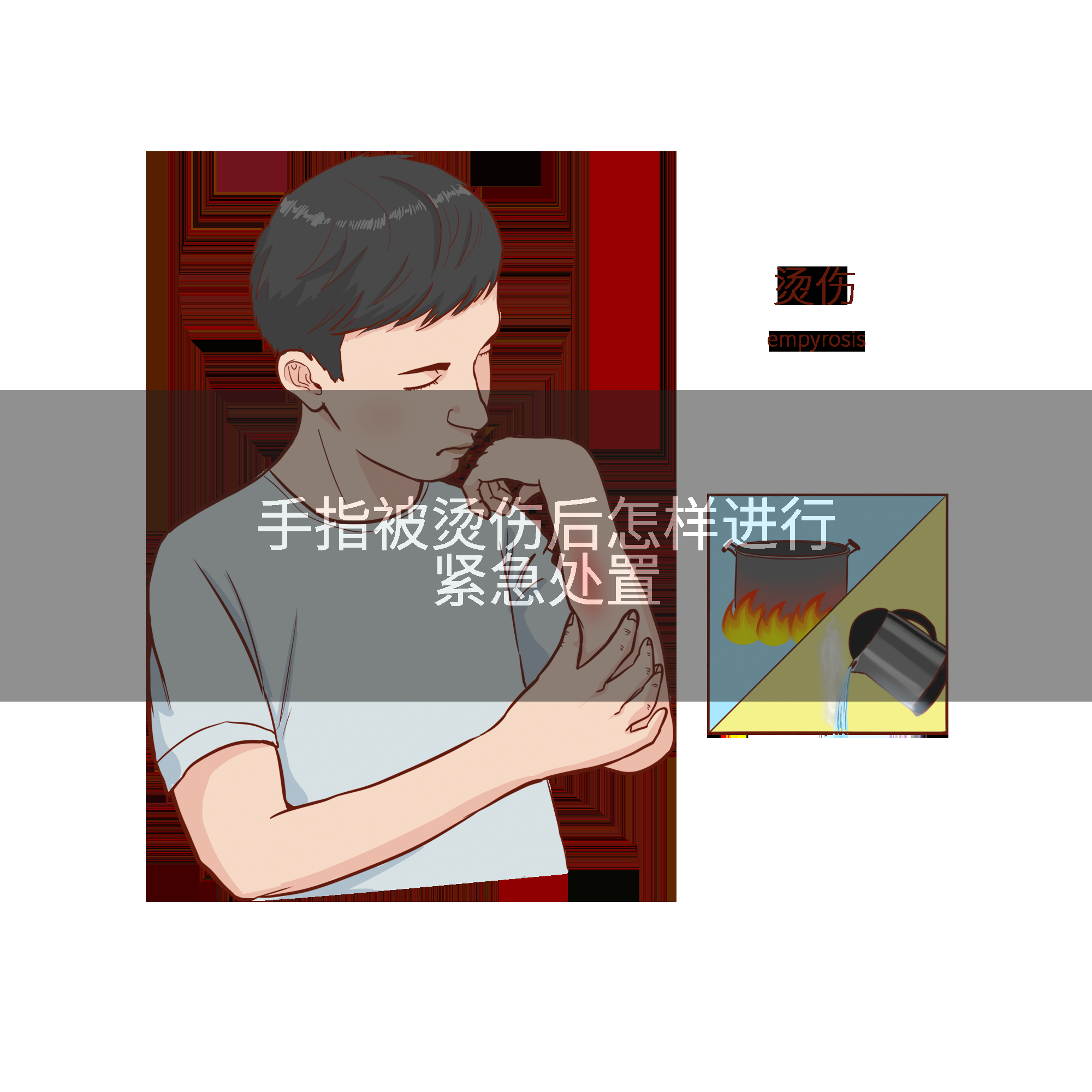 手指被烫伤后怎样进行紧急处置