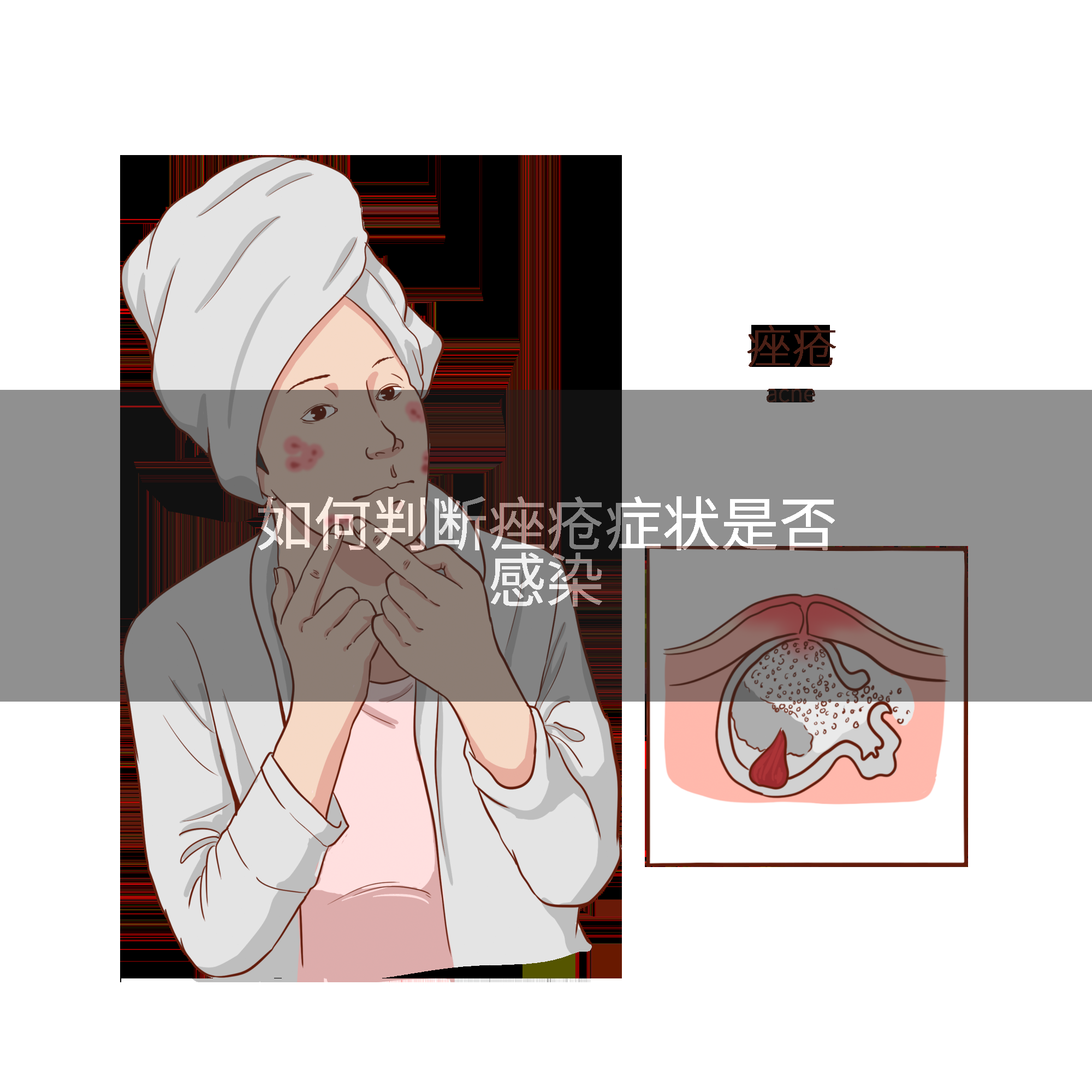 如何判断痤疮症状是否感染