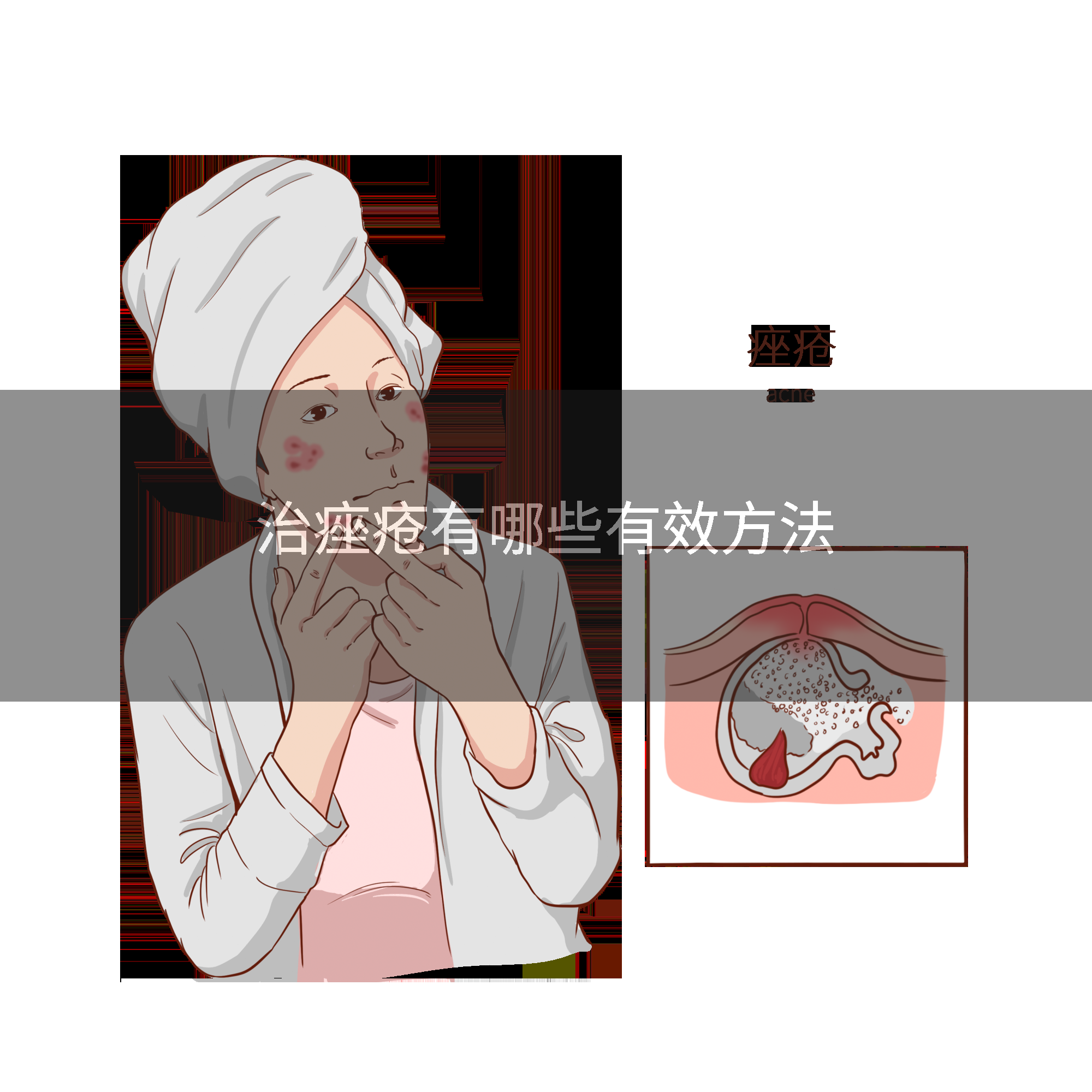 治痤疮有哪些有效方法