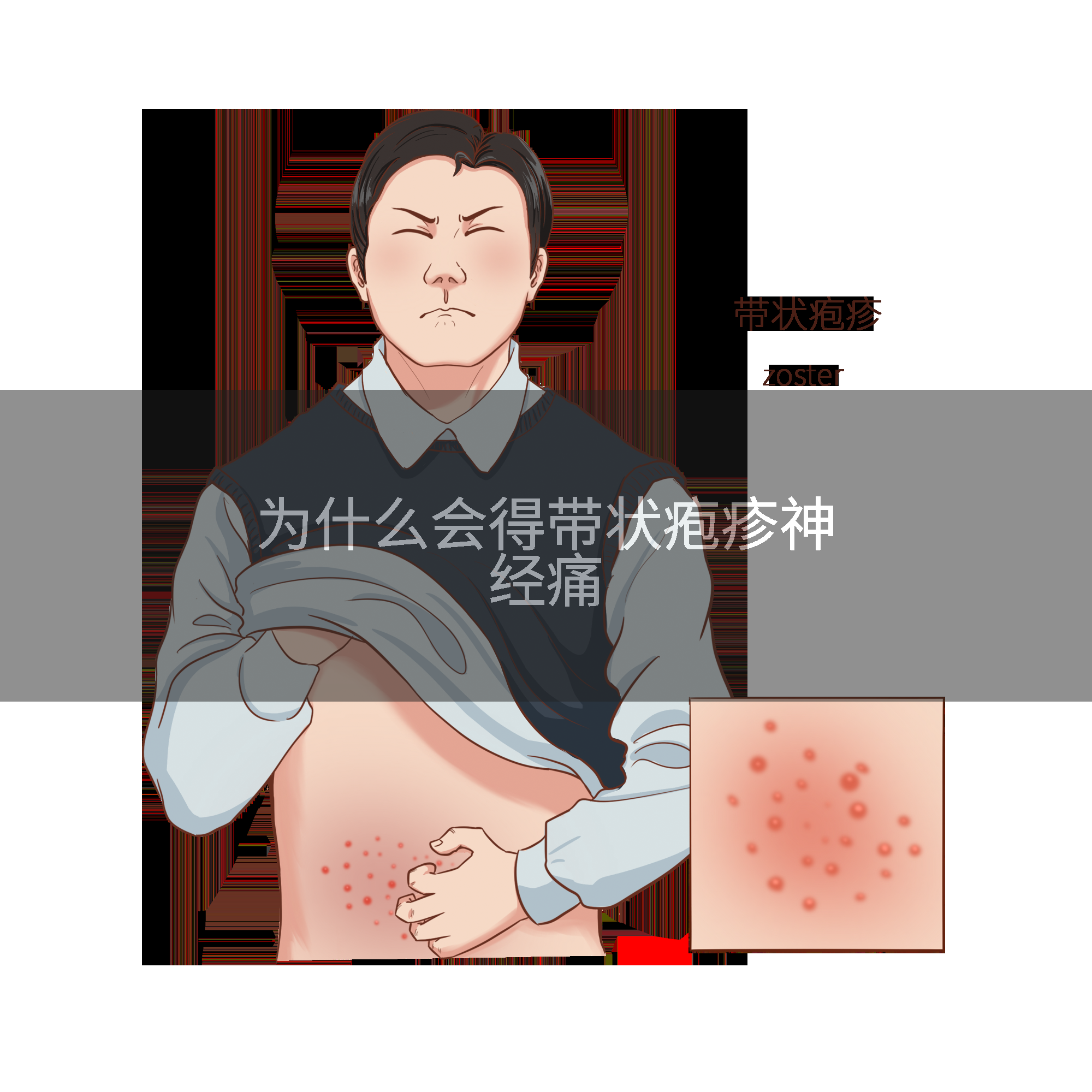 为什么会得带状疱疹神经痛