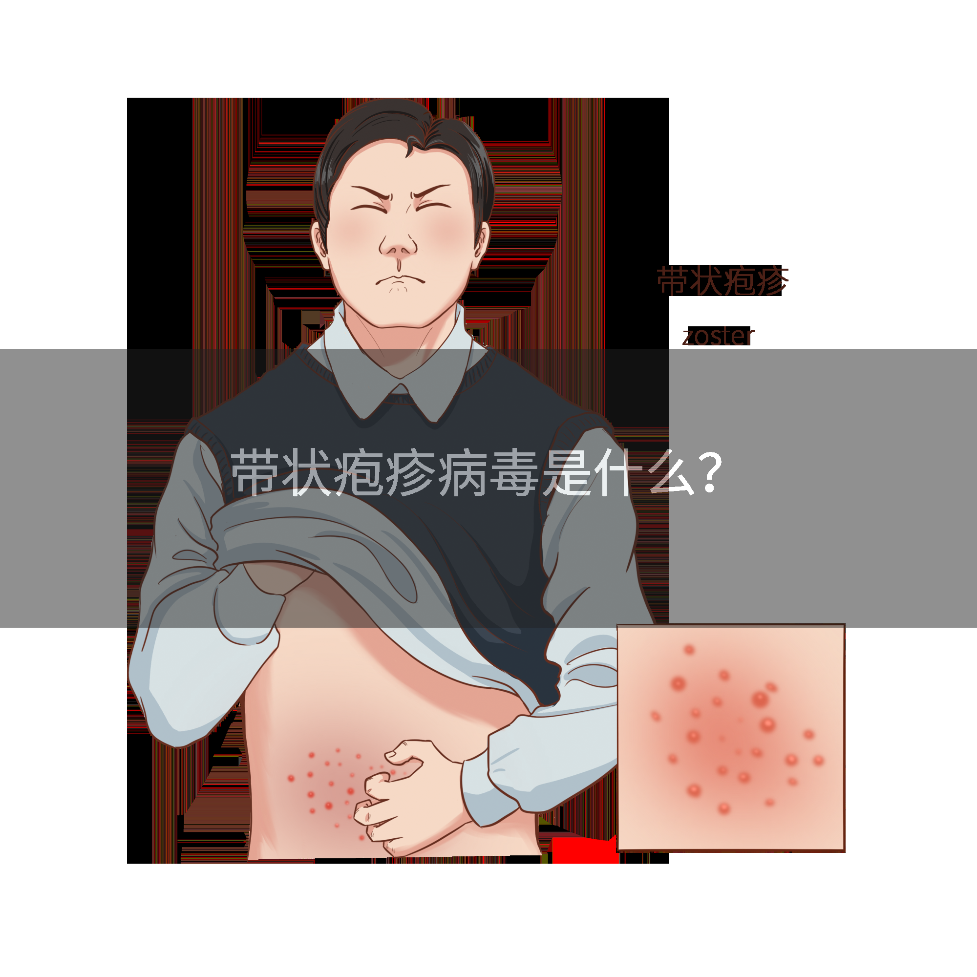 带状疱疹病毒是什么？