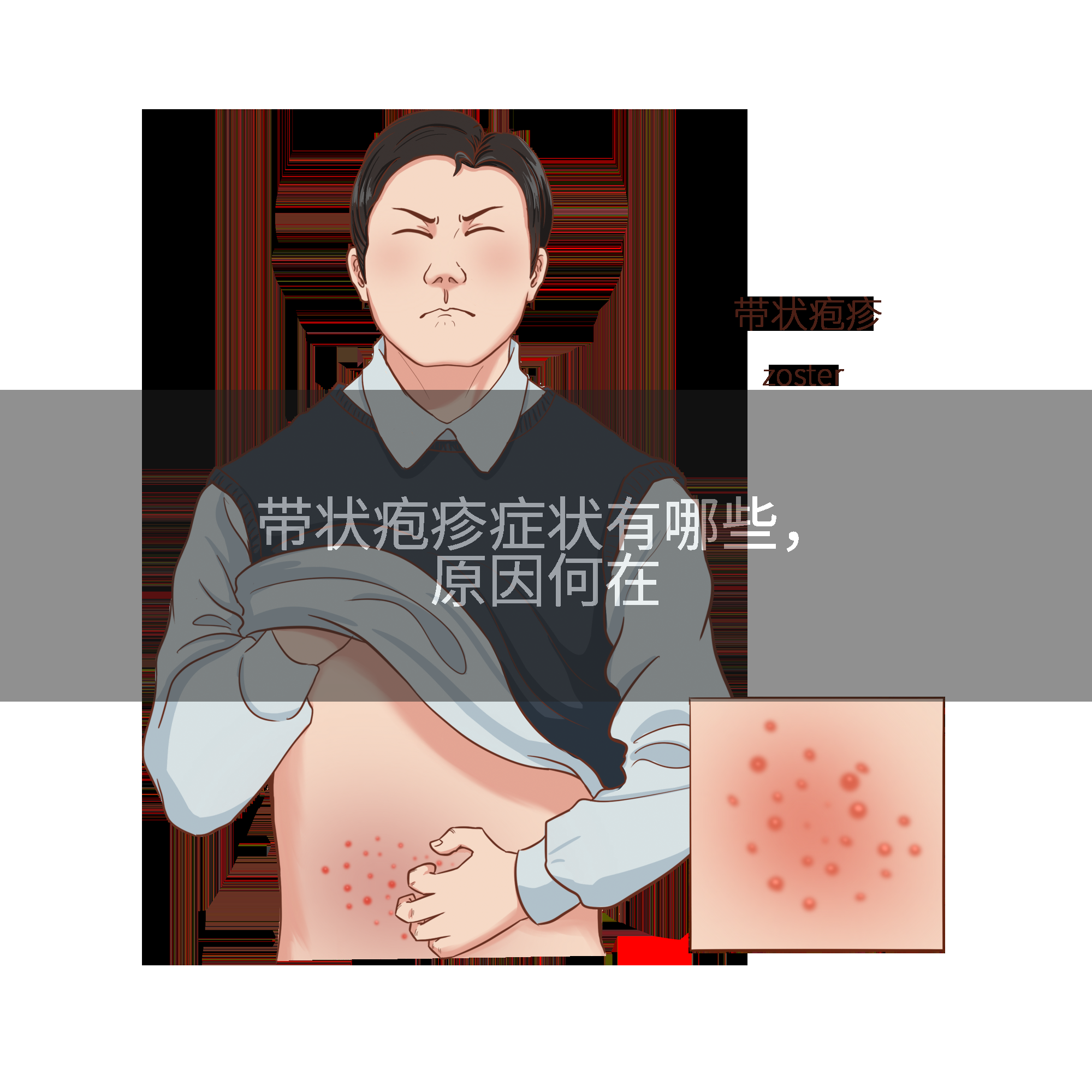 带状疱疹症状有哪些，原因何在