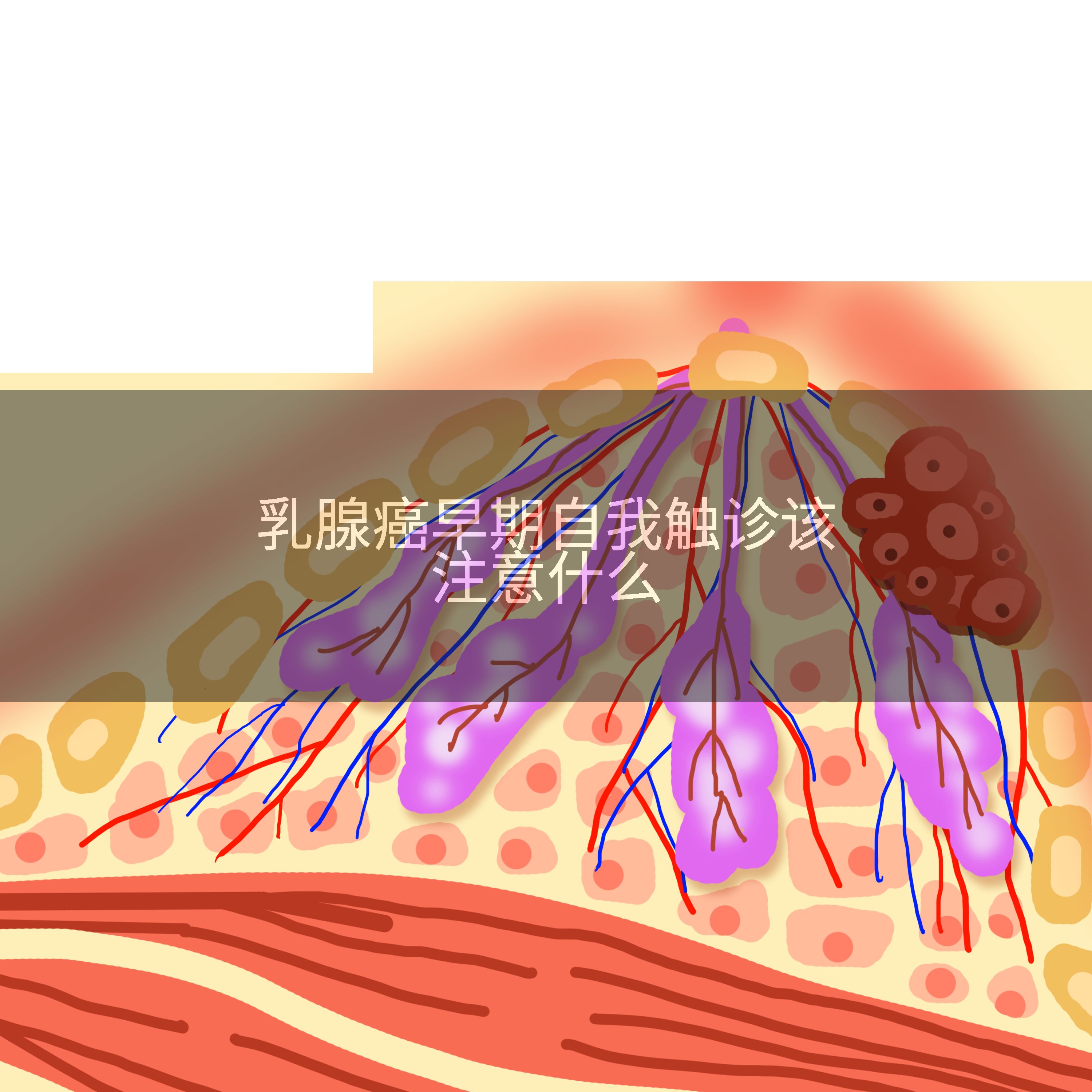 乳腺癌早期自我触诊该注意什么
