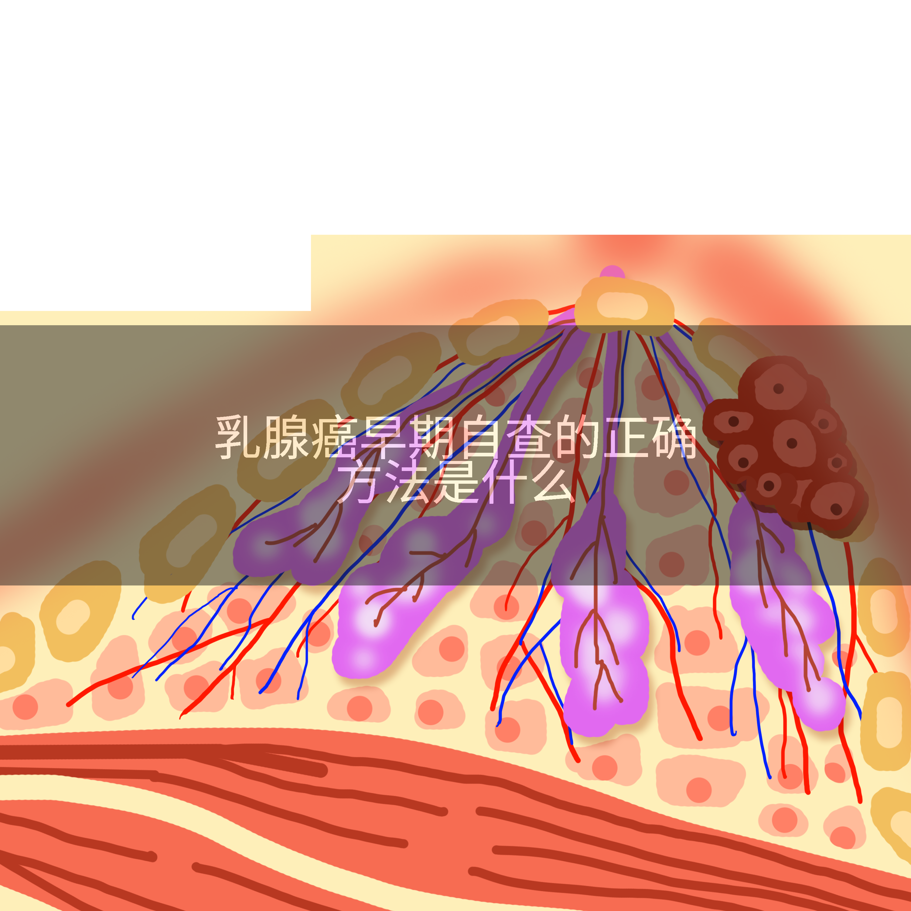 乳腺癌早期自查的正确方法是什么