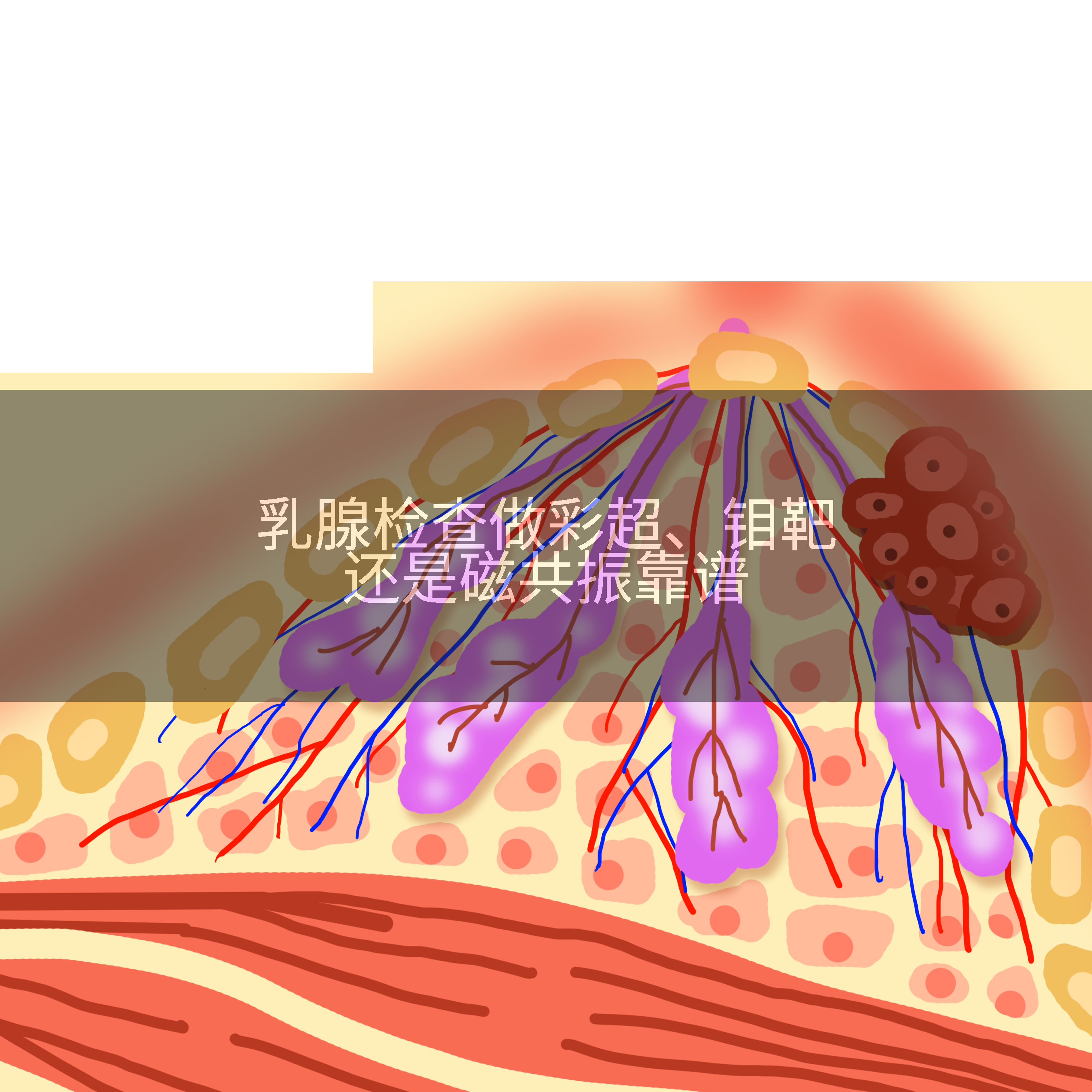 乳腺检查做彩超、钼靶还是磁共振靠谱