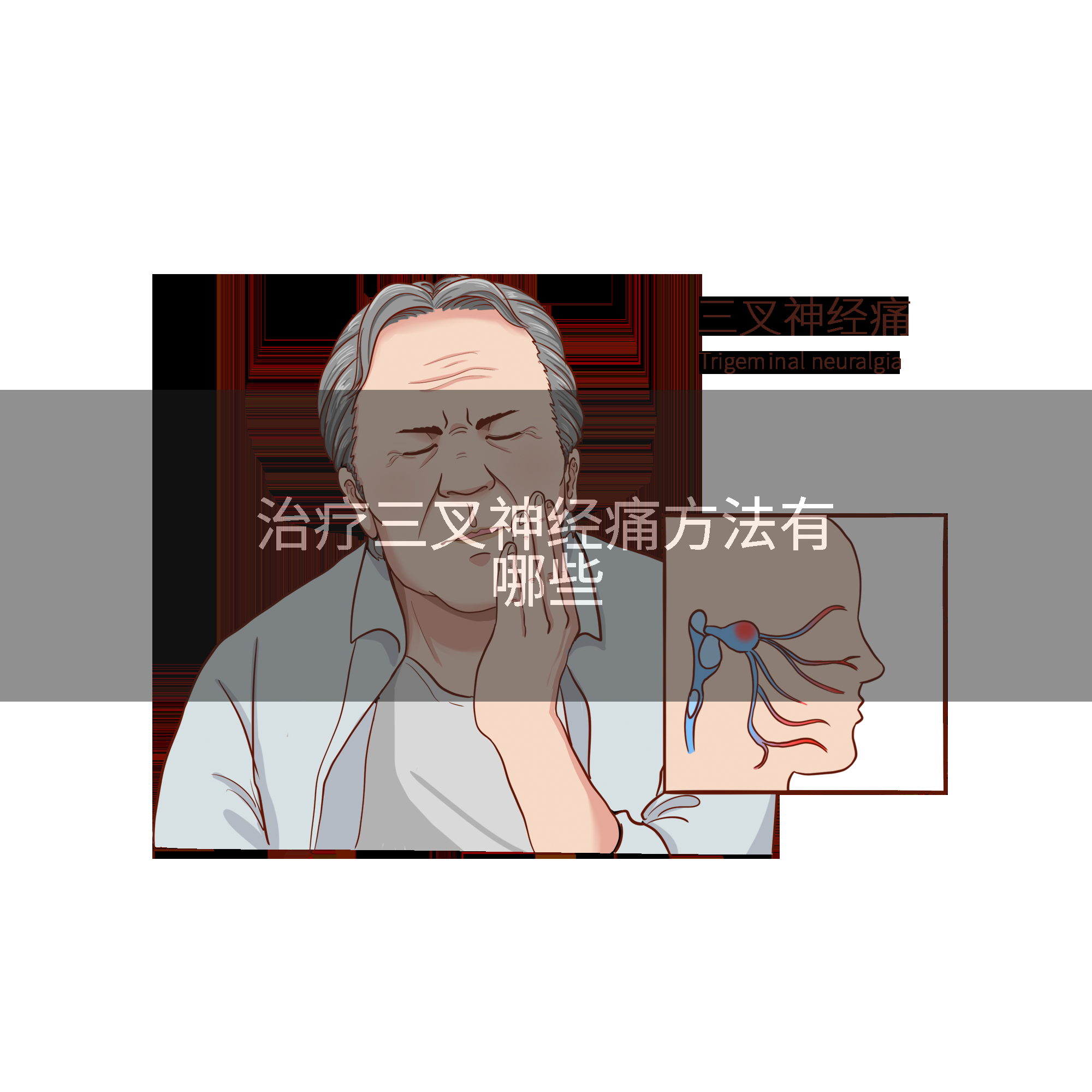 治疗三叉神经痛方法有哪些