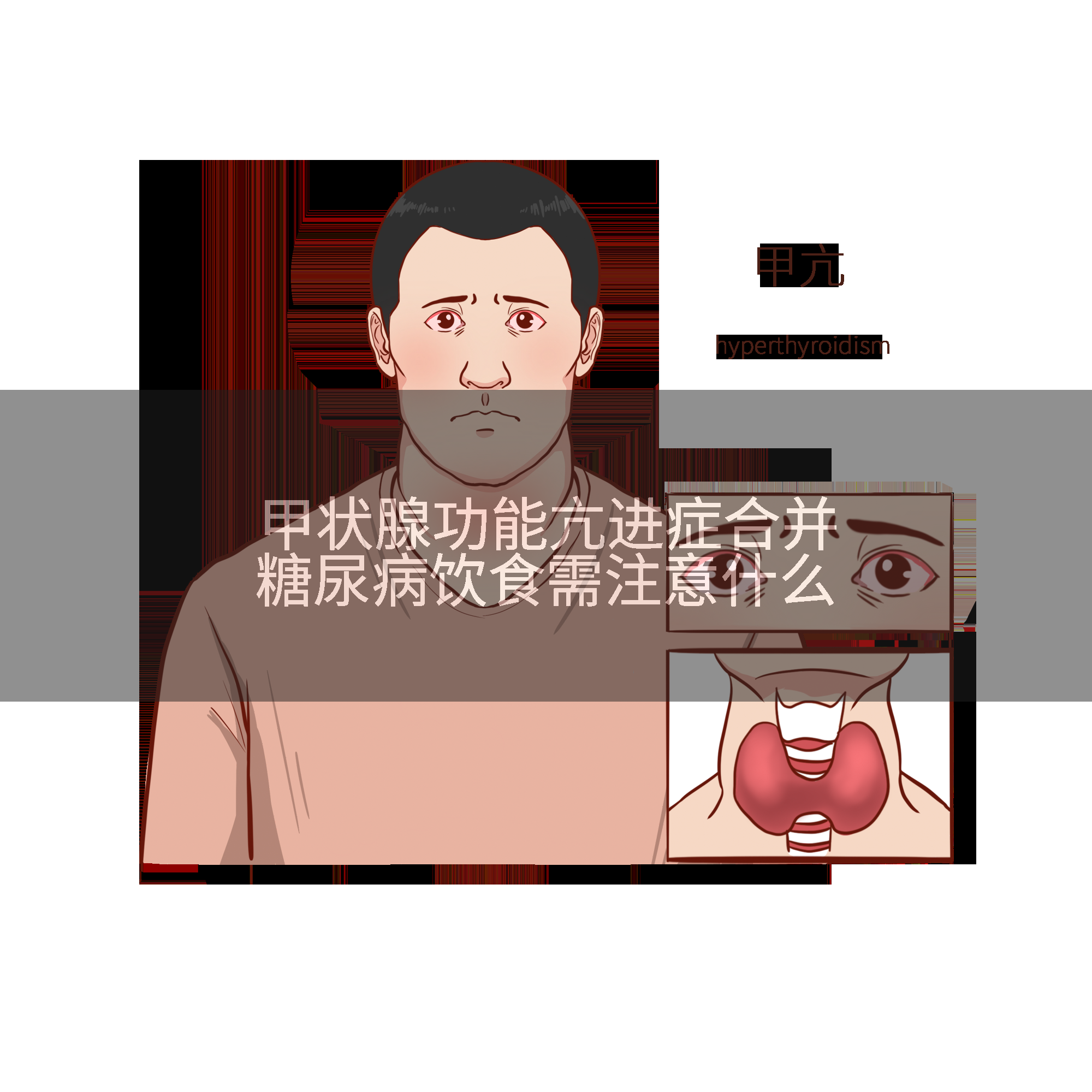 甲状腺功能亢进症合并糖尿病饮食需注意什么