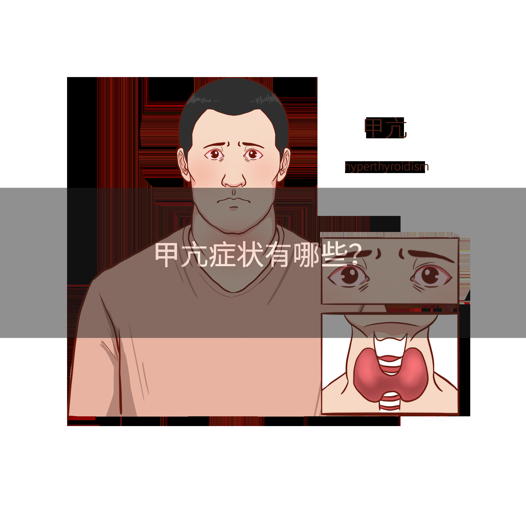 甲亢症状有哪些？