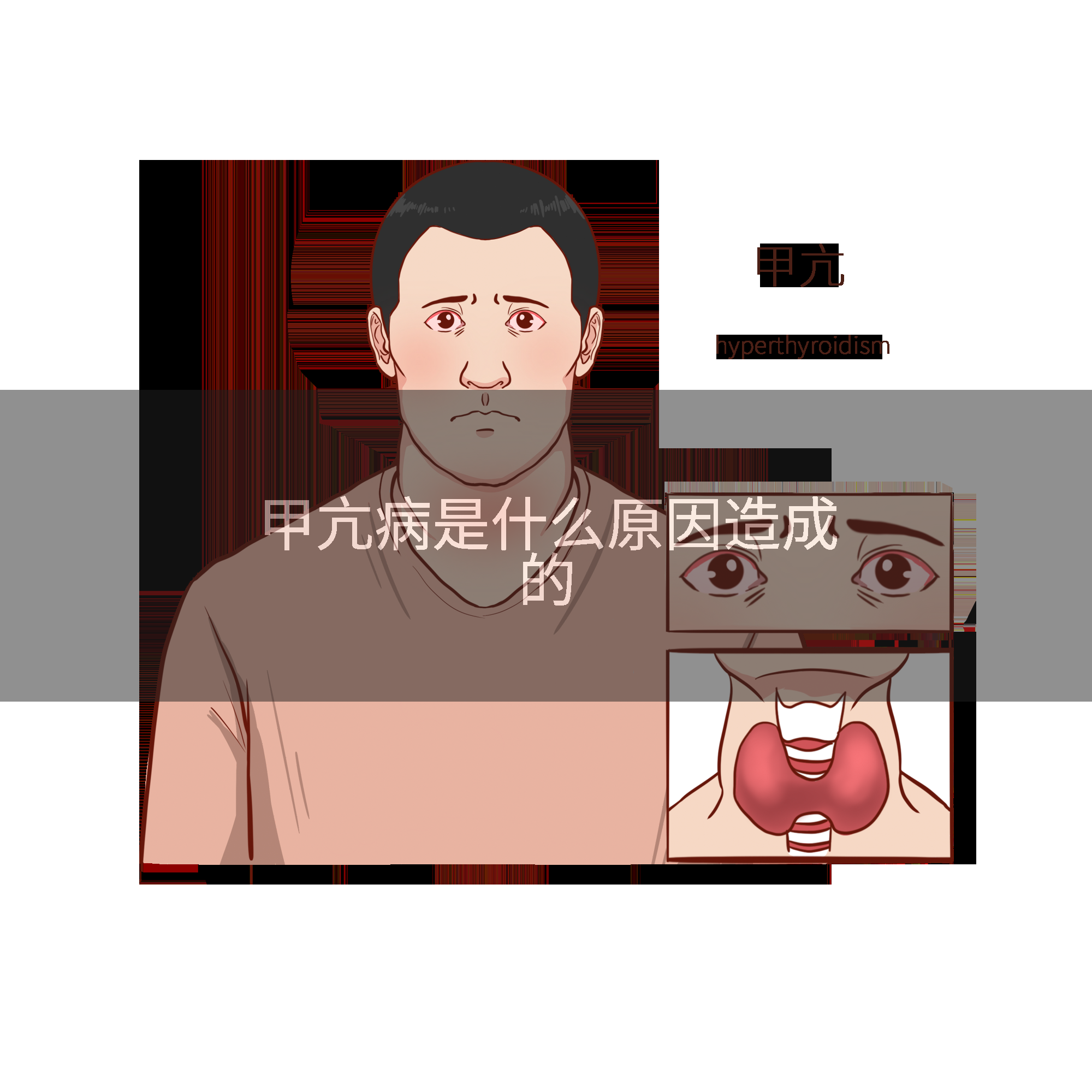 甲亢病是什么原因造成的