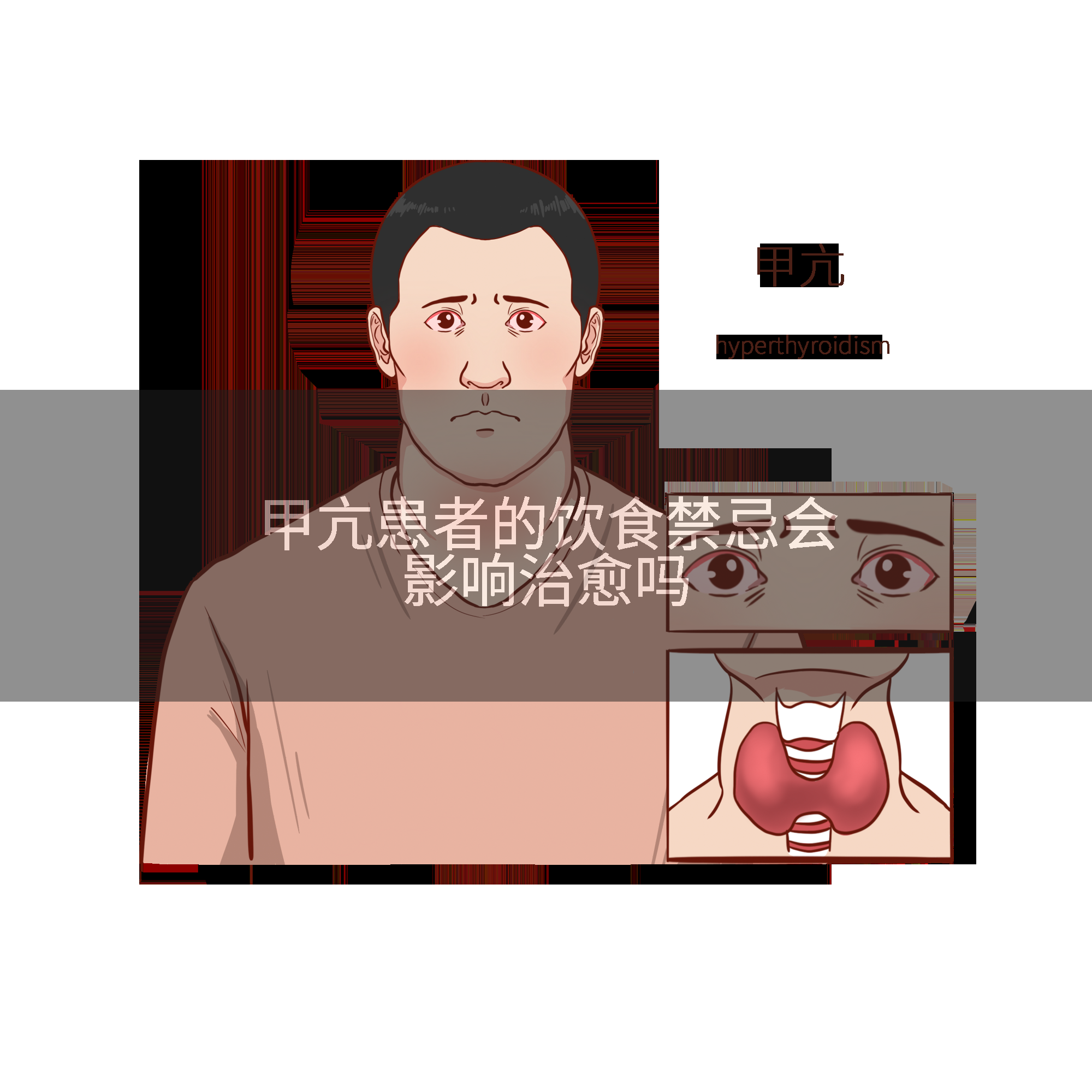 甲亢患者的饮食禁忌会影响治愈吗