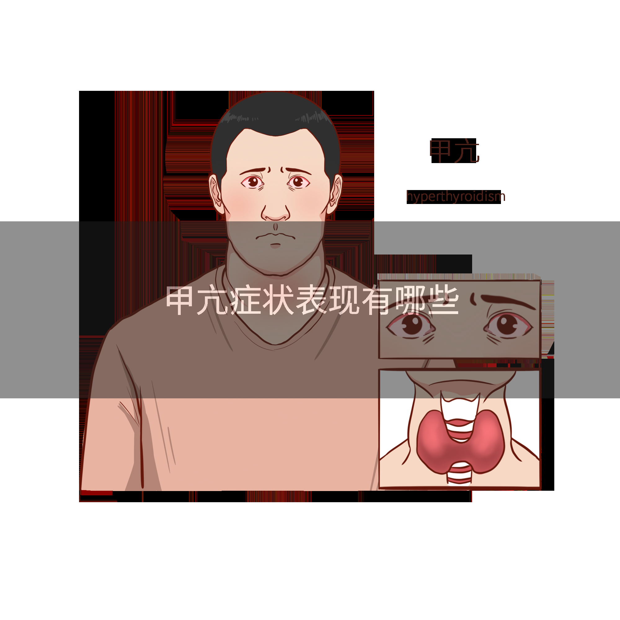 甲亢症状表现有哪些