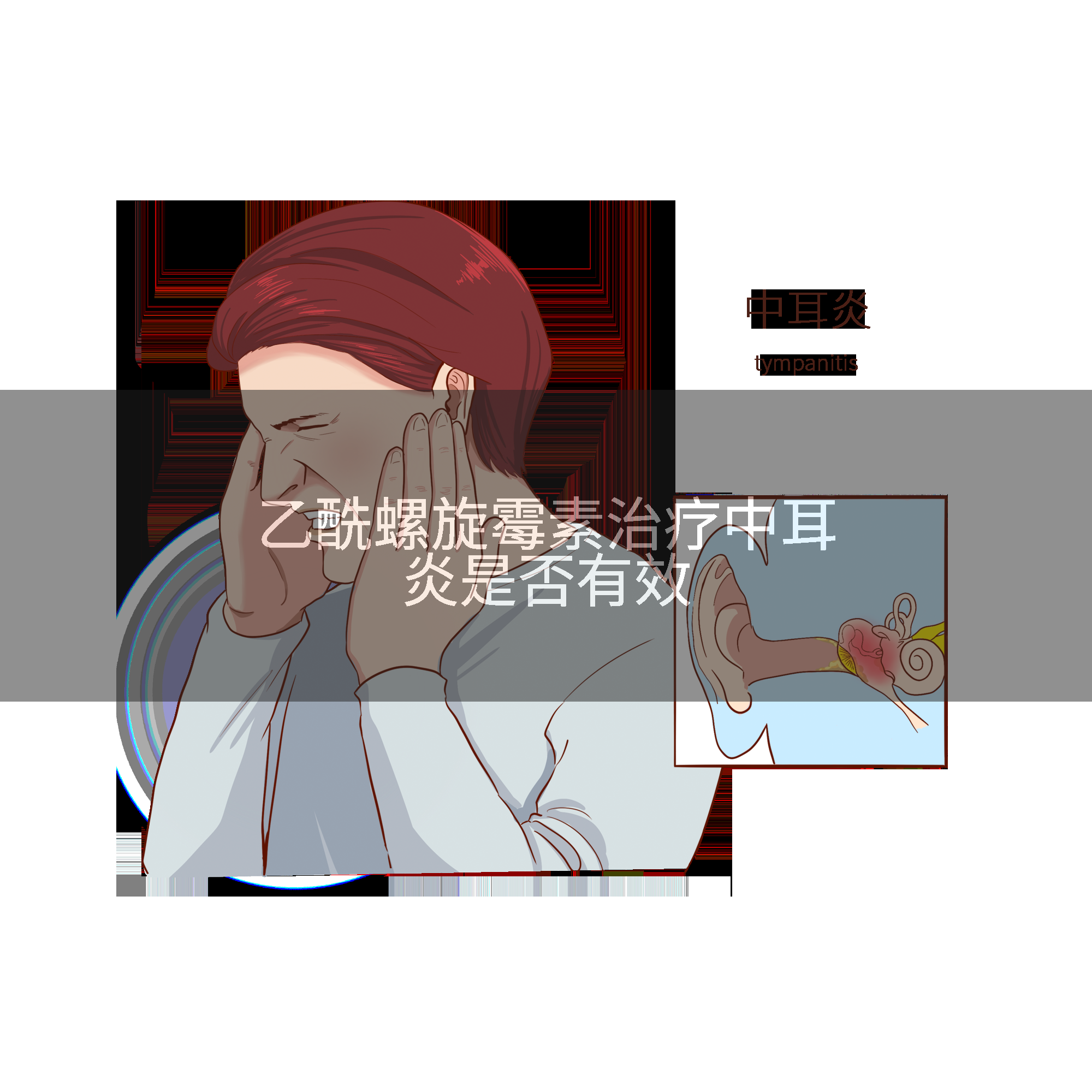 乙酰螺旋霉素治疗中耳炎是否有效