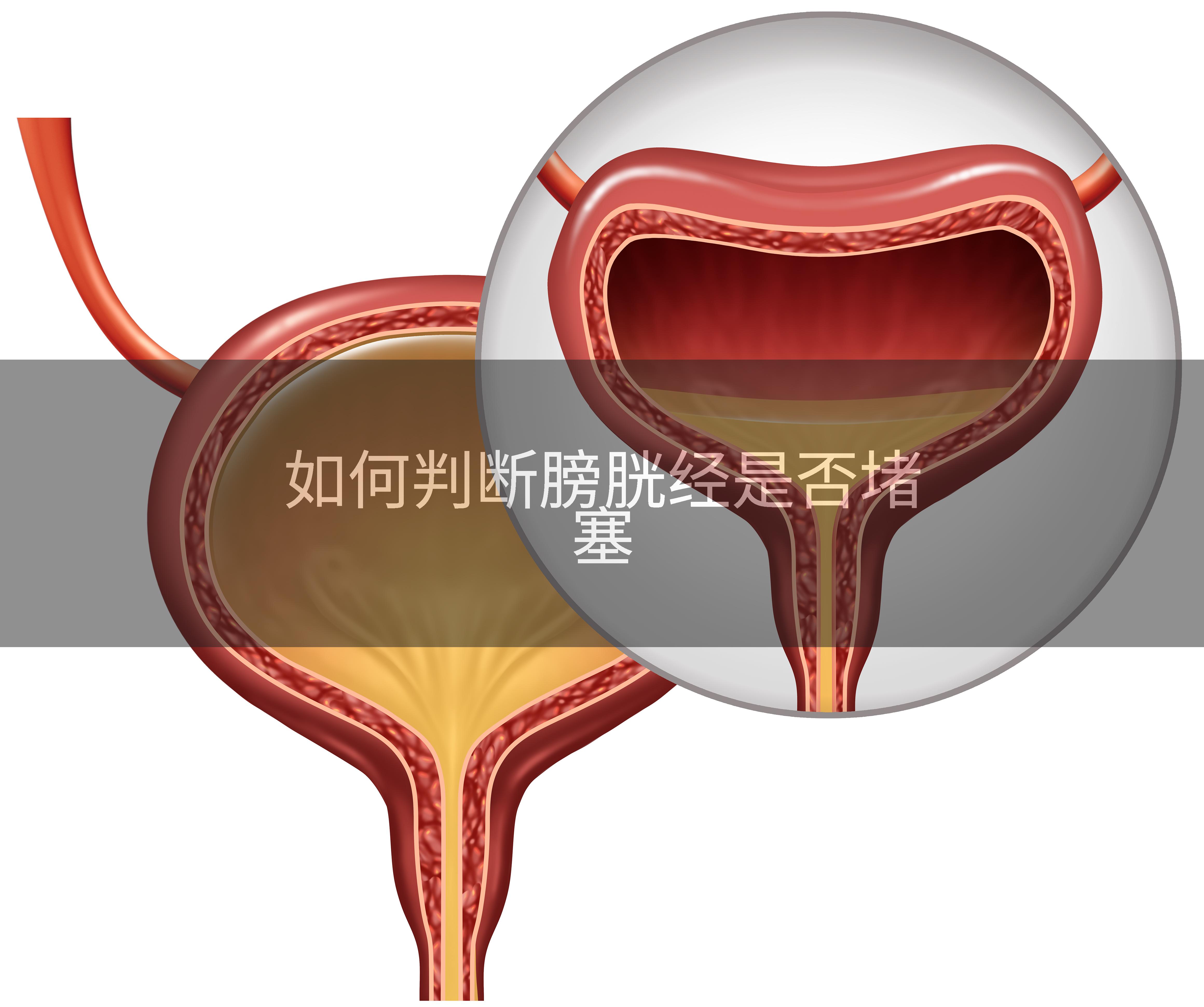 如何判断膀胱经是否堵塞