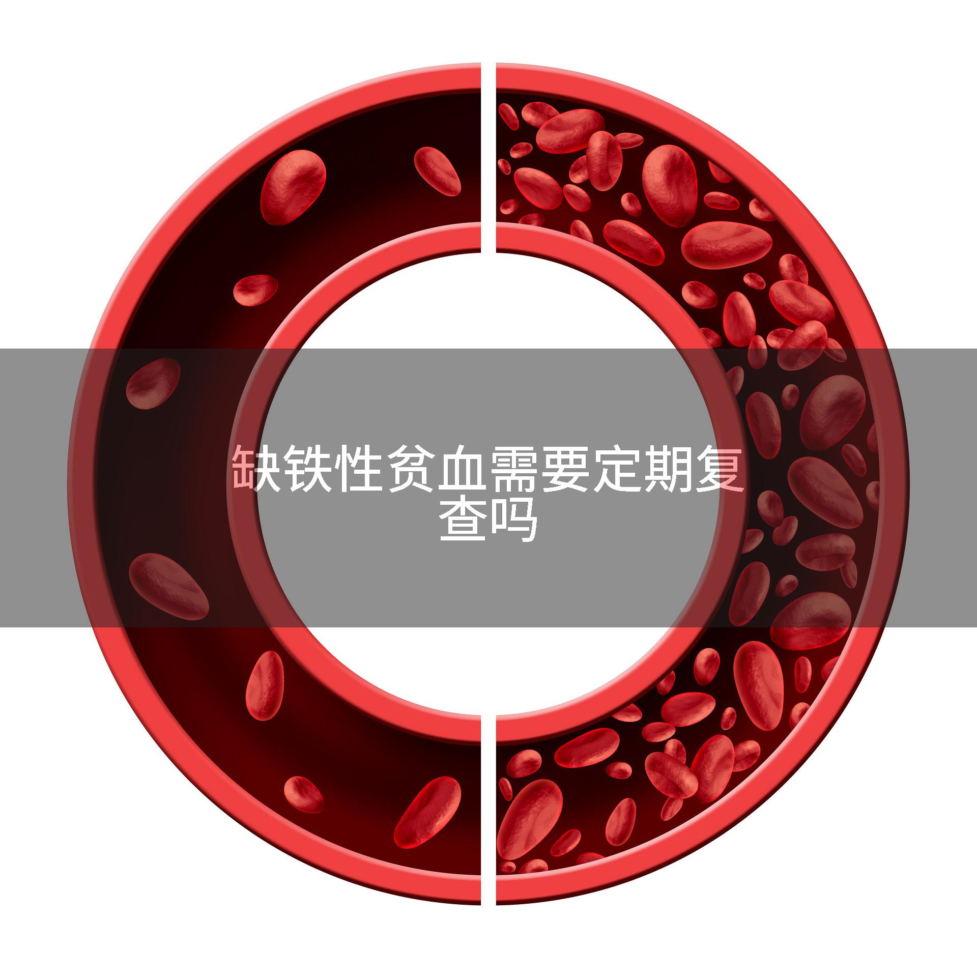 缺铁性贫血需要定期复查吗