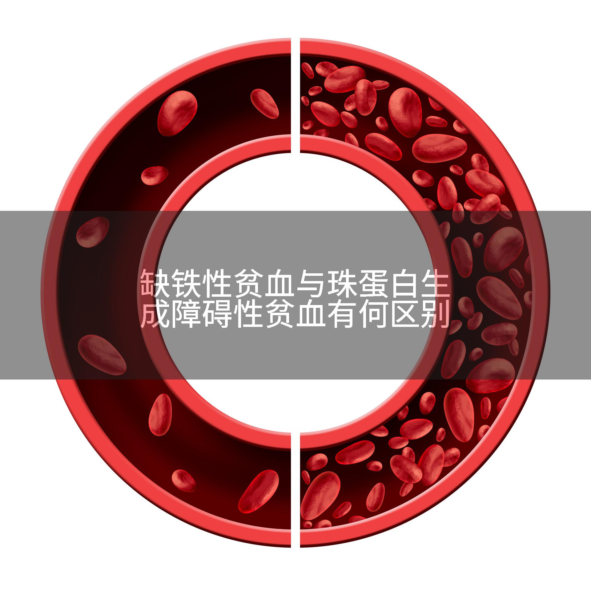 缺铁性贫血与珠蛋白生成障碍性贫血有何区别