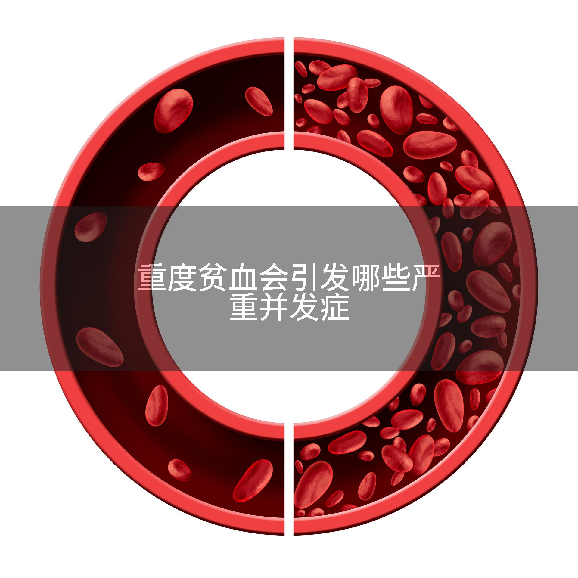 重度贫血会引发哪些严重并发症