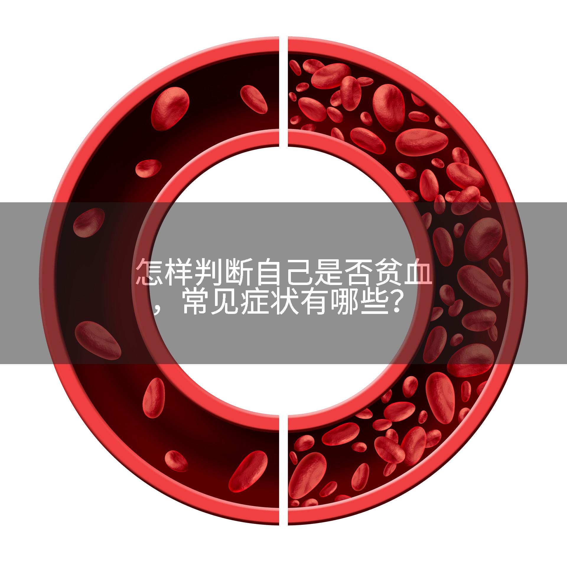 怎样判断自己是否贫血,常见症状有哪些?