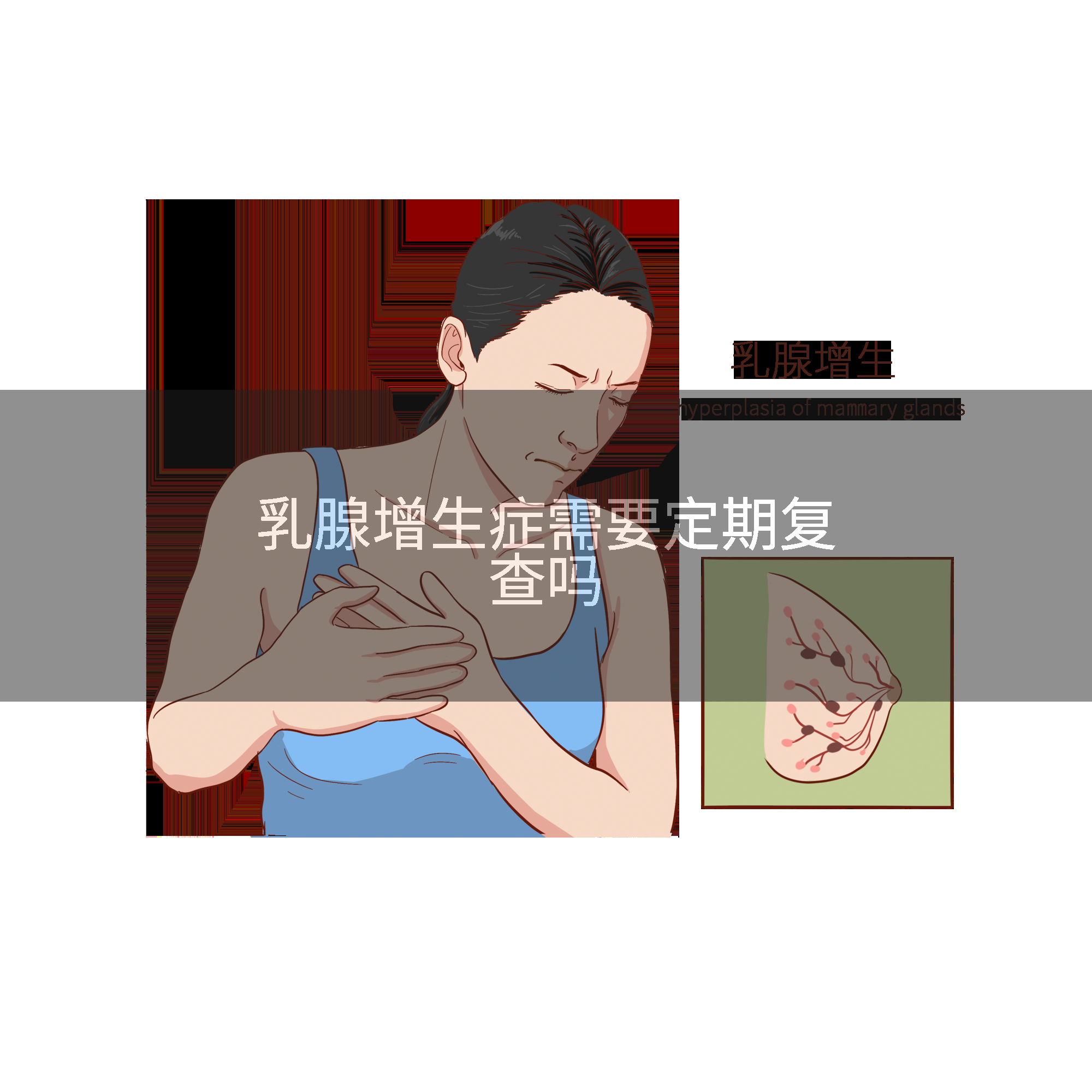 乳腺增生症需要定期复查吗
