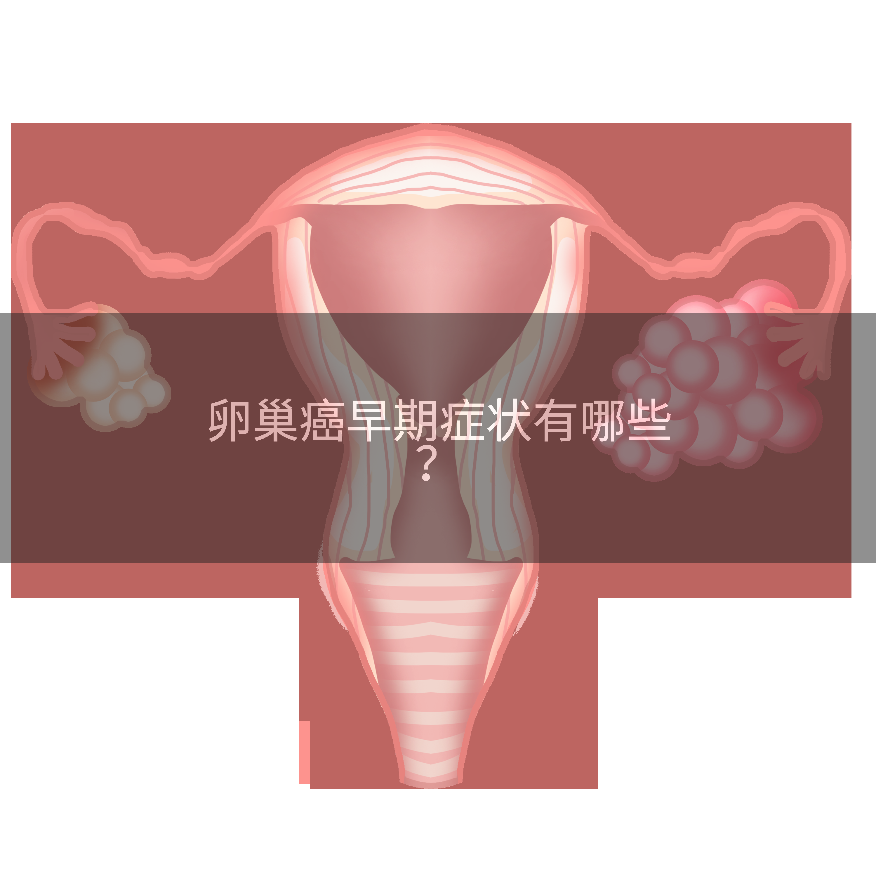 卵巢癌早期症状有哪些？