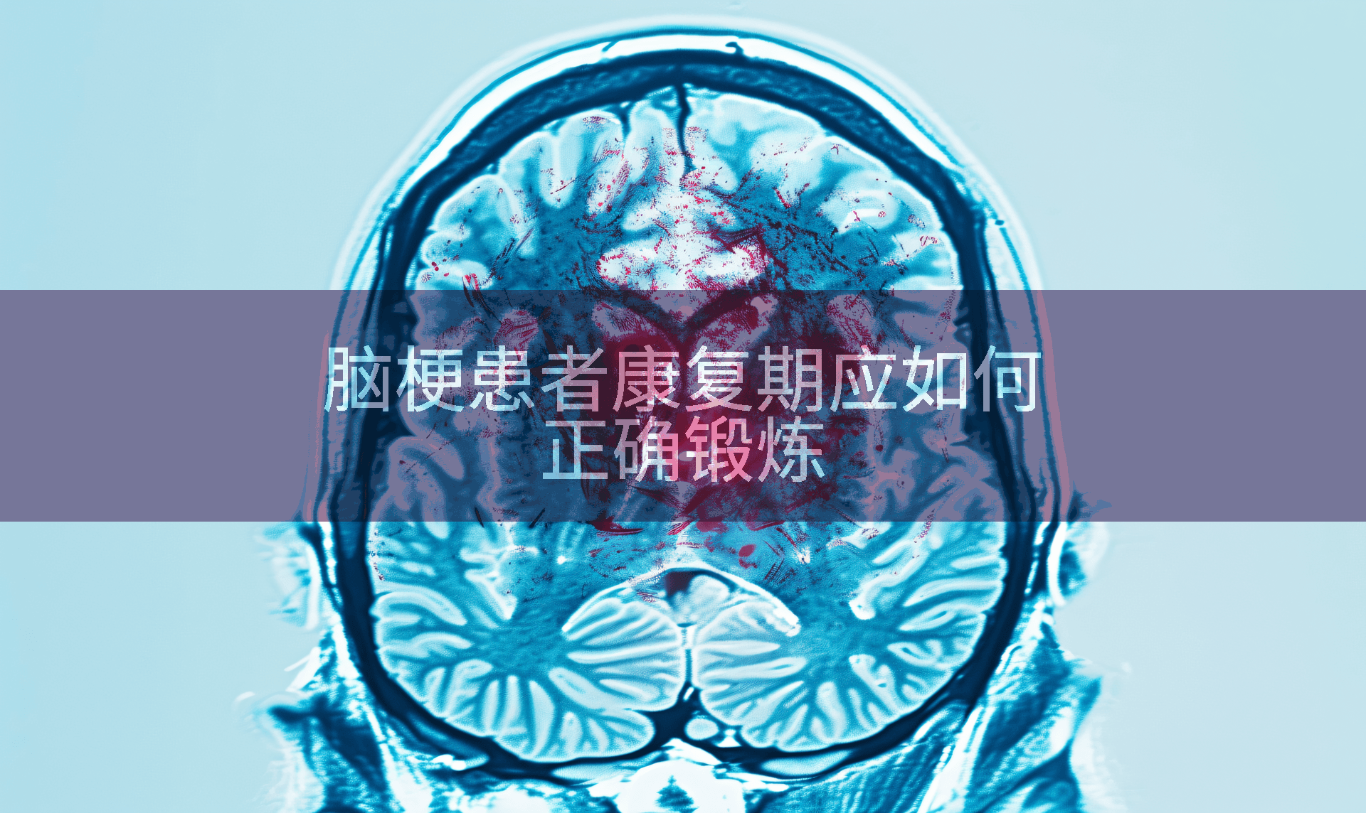 脑梗患者康复期应如何正确锻炼