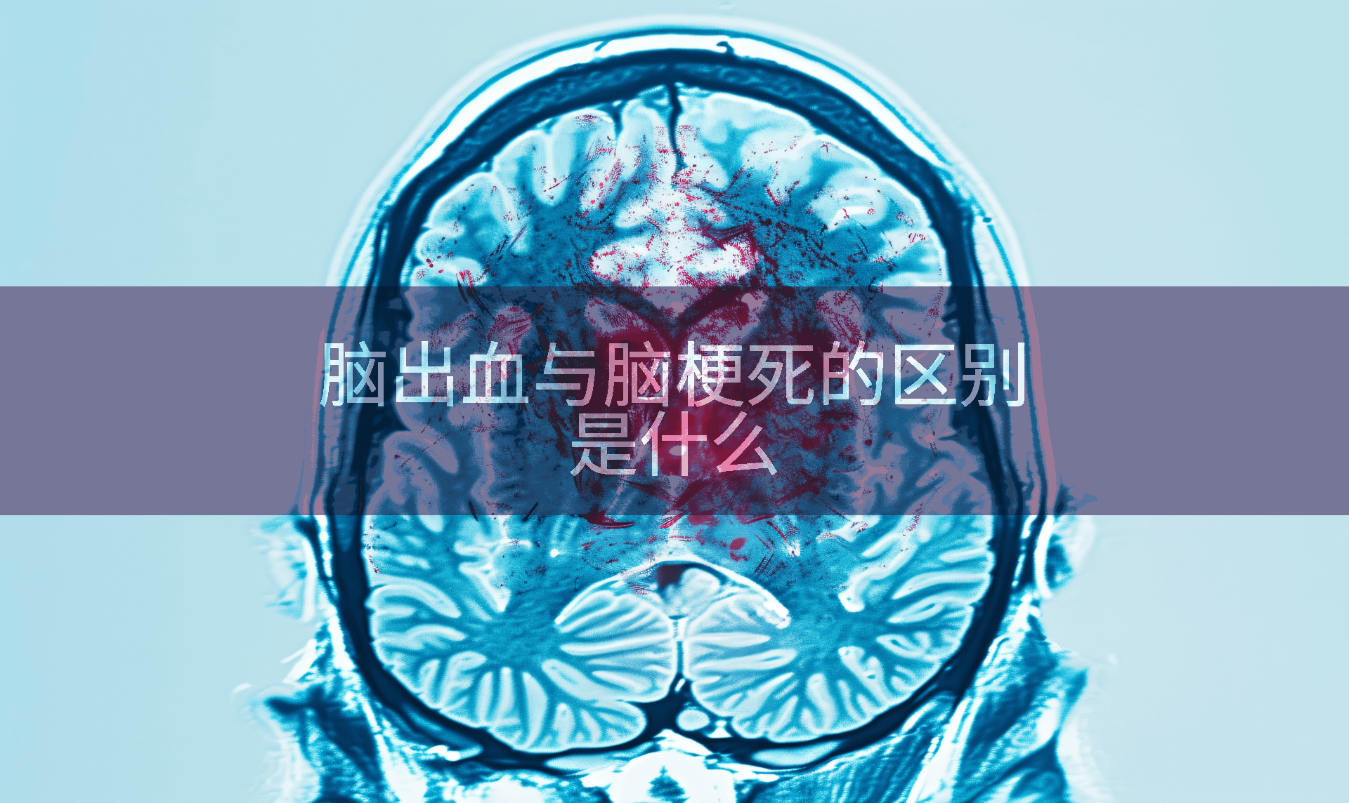 脑出血与脑梗死的区别是什么
