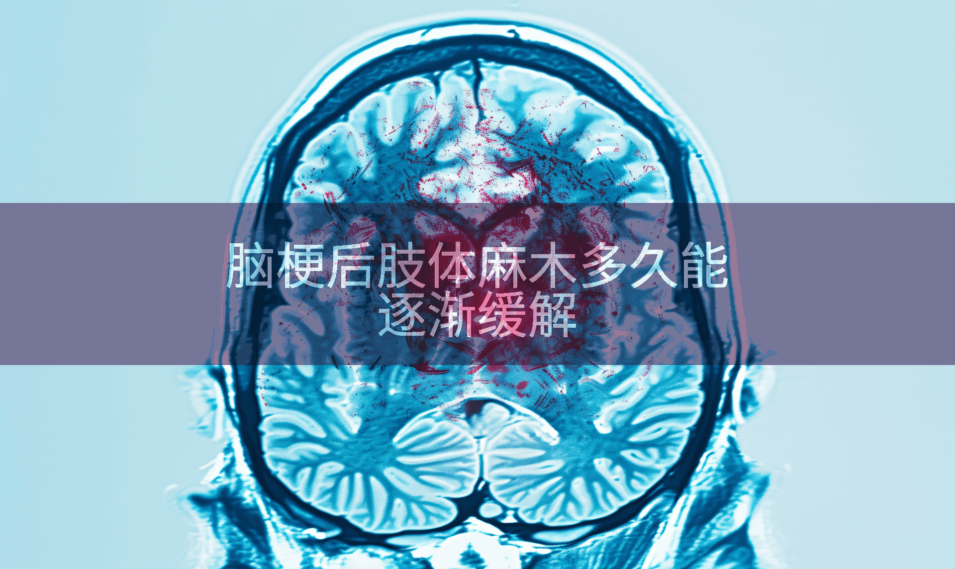 脑梗后肢体麻木多久能逐渐缓解