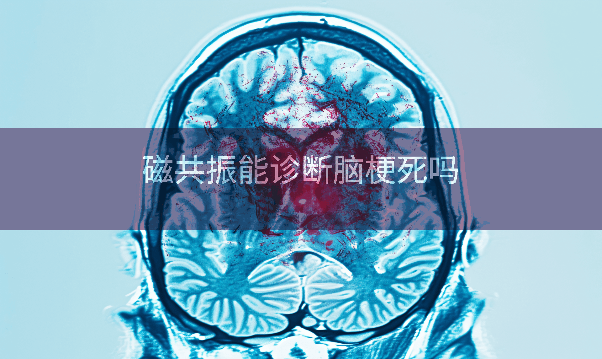 磁共振能诊断脑梗死吗