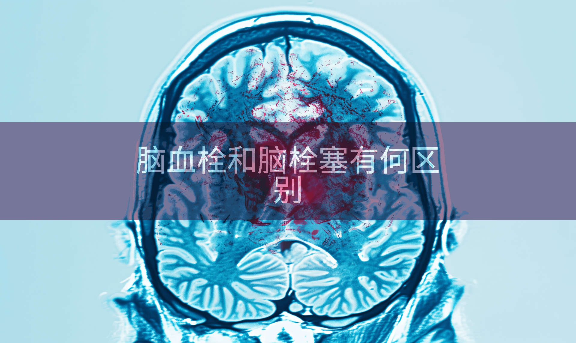 脑血栓和脑栓塞有何区别