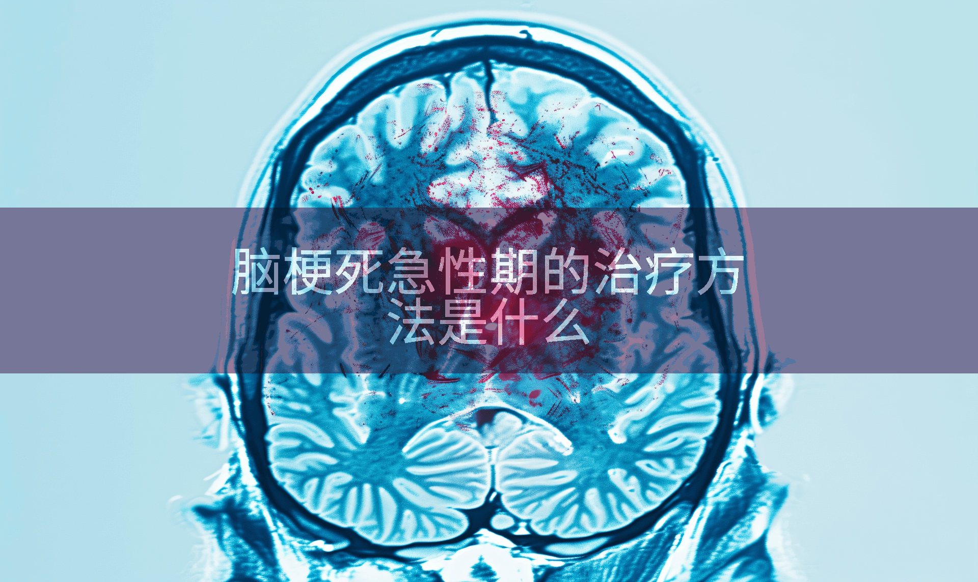 脑梗死急性期的治疗方法是什么