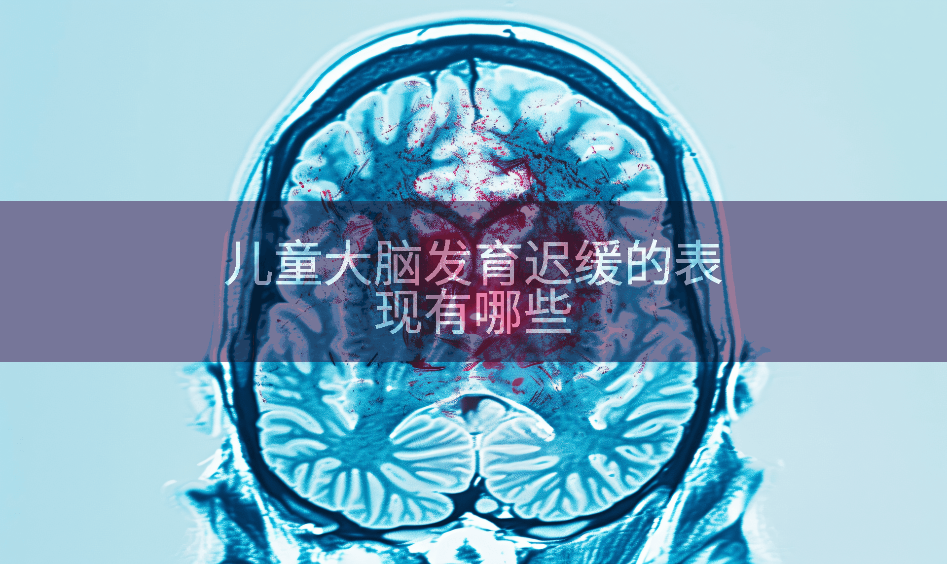 儿童大脑发育迟缓的表现有哪些